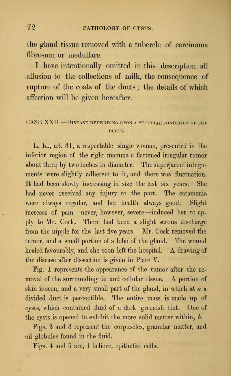 the gland tissue removed with a tubercle of carcinoma fibrosum or medullare. I have intentionally omitted in this description all allusion to the collections of milk, the consequence of rupture of the coats of the ducts ; the details of which affection will be given hereafter. CASE XXII.—Disease depending upon a peculiak condition of the ducts. L. K., set. 31, a respectable single woman, presented in the inferior region of the right mamma a flattened irregular tumor about three by two inches in diameter. The superjacent integu- ments were slightly adherent to it, and there was fluctuation. It had been slowly increasing in size the last six years. She had never received any injury to the part. The catamenia were always regular, and her health always good. Slight increase of pain—never, however, severe—induced her to ap- ply to Mr. Cock. There had been a slight serous discharge from the nipple for the last five years. Mr. Cock removed the tumor, and a small portion of a lobe of the gland. The wound healed favourably, and she soon left the hospital. A drawing of the disease after dissection is given in Plate V. Tig. 1 represents the appearance of the tumor after the re- moval of the surrounding fat and cellular tissue. A portion of skin is seen, and a very small part of the gland, in which at a a divided duct is perceptible. The entire mass is made up of cysts, which contained fluid of a dark greenish tint. One of the cysts is opened to exhibit the more solid matter within, b. Tigs. 2 and 3 represent the corpuscles, granular matter, and oil globules found in the fluid. Figs. 4 and 5 are, I believe, epithelial cells.