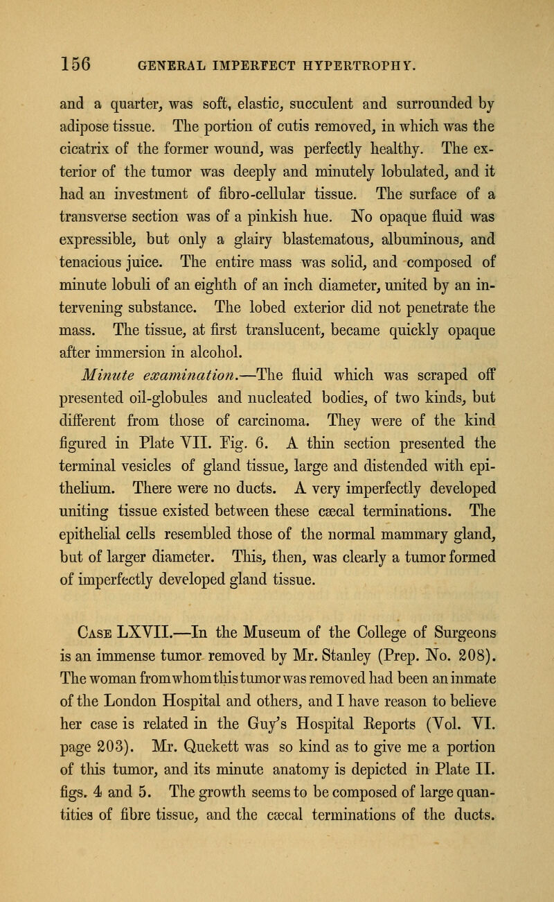 and a quarter, was soft, elastic, succulent and surrounded by adipose tissue. The portion of cutis removed, in which was the cicatrix of the former wound, was perfectly healthy. The ex- terior of the tumor was deeply and minutely lobulated, and it had an investment of fibro-cellular tissue. The surface of a transverse section was of a pinkish hue. No opaque fluid was expressible, but only a glairy blastematous, albuminous, and tenacious juice. The entire mass was solid, and composed of minute lobuli of an eighth of an inch diameter, united by an in- tervening substance. The lobed exterior did not penetrate the mass. The tissue, at first translucent, became quickly opaque after immersion in alcohol. Minute examination.—The fluid which was scraped off presented oil-globules and nucleated bodies, of two kinds, but different from those of carcinoma. They were of the kind figured in Plate VII. Pig. 6. A thin section presented the terminal vesicles of gland tissue, large and distended with epi- thelium. There were no ducts. A very imperfectly developed uniting tissue existed between these cascal terminations. The epithelial cells resembled those of the normal mammary gland, but of larger diameter. This, then, was clearly a tumor formed of imperfectly developed gland tissue. Case LXVII.—In the Museum of the College of Surgeons is an immense tumor removed by Mr. Stanley (Prep. No. 208). The woman from whom this tumor was removed had been an inmate of the London Hospital and others, and I have reason to believe her case is related in the Guy's Hospital Reports (Vol. VI. page 203). Mr. Quekett was so kind as to give me a portion of this tumor, and its minute anatomy is depicted in Plate II. figs. 4 and 5. The growth seems to be composed of large quan- tities of fibre tissue, and the csecal terminations of the ducts.