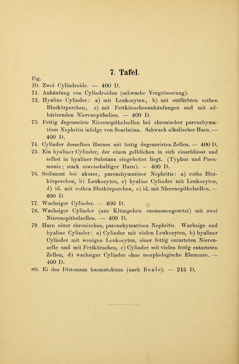 7. Tafel. Fig. 70. Zwei Cylindroide. — 400 D. 71. Anhäufung von Cylindroiden (schwache Vergrösserung). 72. Hyaline Cylinder: a) mit Leukocyten, b) mit entfärbten rothen Blutkörperchen, c) mit Fettkörnchenanhäufungen und mit ad- härirenden Nierenepithelien. — 400 D. 73. Fettig degenerirte Nierenepithelzellen bei chronischer parenchyma- töser Nephritis infolge von Scarlatina. Schwach alkalischer Harn.— 400 D. 74. Cylinder desselben Harnes mit fettig degenerirten Zellen. — 400 D. 75. Ein hyaliner Cylinder, der einen gelblichen in sich einschliesst und selbst in hyaliner Substanz eingebettet liegt. (Typhus und Pneu- monie ; stark eiweisshaltiger Harn). — 400 D. 76. Sediment bei akuter, parenchymatöser Nephritis: a) rothe Blut- körperchen, b) Leukocyten, c) hyaline Cylinder mit Leukocyten, d) id. mit rothen Blutkörperchen, e) id. mit Nierenepithelzellen. — 400 D. 77. Wachsiger Cylinder. — 400 D. 78. Wachsiger Cylinder (aus Klümpchen zusammengesetzt) mit zwei Nierenepithelzellen. — 400 D. 79. Harn einer chronischen, parenchymatösen Nephritis. Wachsige und hyaline Cylinder: a) Cylinder mit vielen Leukocyten, b) hyaliner Cylinder mit wenigen Leukocyten, einer fettig entarteten Nieren- zelle und mit Fettkörnchen, c) Cylinder mit vielen fettig entarteten Zellen, d) wachsiger Cylinder ohne morphologische Elemente. — 400 D. 80. Ei des Distomum haematobium (nach Beale). — 215 D.