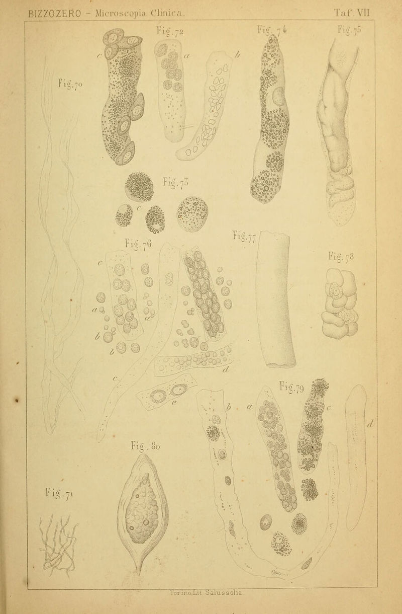/OZERO ;copia Cliriica. Taf VII r i 'j 72 A 53» „•/ i.f.V' Fi€.76 Fi€.7' - / i I vi. 7« ' .->'-% vi'j , Fi° b a Fvi. o<