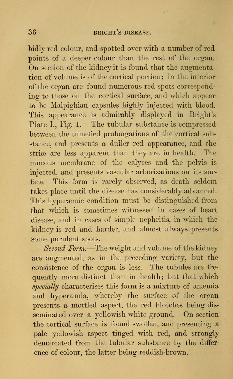 bidly reel colour, and spotted over with a number of red points of a deeper colour than the rest of the organ. On section of the kidney it is found that the augmenta- tion of volume is of the cortical portion; in the interior of the organ are found numerous red spots correspond- ing to those on the cortical surface, and which appear to be Malpighian capsules highly injected with blood. This appearance is admirably displayed in Bright's Plate L, Fig. 1. The tubular substance is compressed between the tumefied prolongations of the cortical sub- stance, and presents a duller red appearance, and the strise are less apparent than they are in health. The mucous membrane of the calyces and the pelvis is injected, and presents vascular arborizations on its sur- face. This form is rarely observed, as death seldom takes place until the disease has considerably advanced. This hyperamiic condition must be distinguished from that which is sometimes witnessed in cases of heart disease, and in cases of simple nephritis, in which the kidney is red and harder, and almost always presents some purulent spots. Second Form.—The weight and volume of the kidney are augmented, as in the preceding variety, but the consistence of the organ is less. The tubules are fre- quently more distinct than in health; but that which specially characterises this form is a mixture of anasmia and hyperemia, whereby the surface of the organ presents a mottled aspect, the red blotches being dis- seminated over a yellowish-white ground. On section the cortical surface is found swollen, and presenting a pale yellowish aspect tinged with red, and strongly demarcated from the tubular substance by the differ- ence of colour, the latter being reddish-brown.