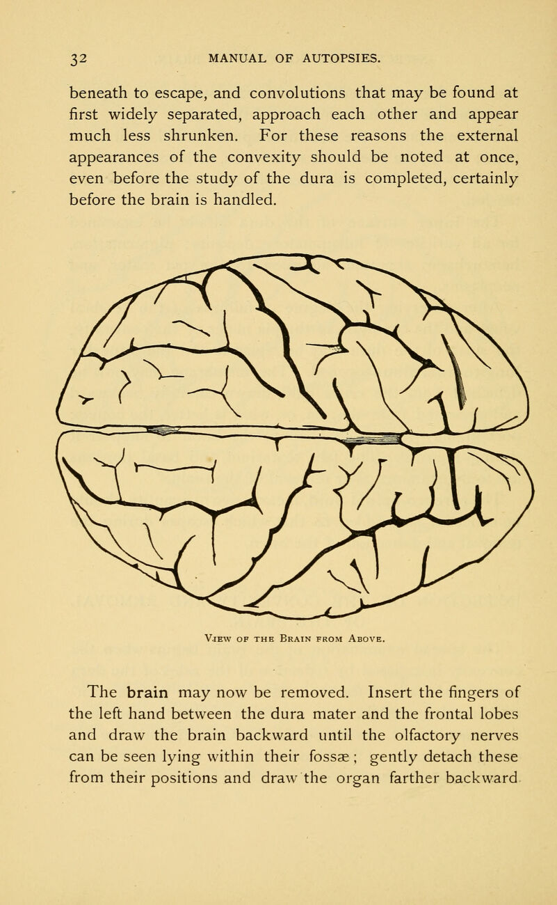 beneath to escape, and convolutions that may be found at first widely separated, approach each other and appear much less shrunken. For these reasons the external appearances of the convexity should be noted at once, even before the study of the dura is completed, certainly before the brain is handled. V.iew of the Brain from Above. The brain may now be removed. Insert the fingers of the left hand between the dura mater and the frontal lobes and draw the brain backward until the olfactory nerves can be seen lying within their fossae ; gently detach these from their positions and draw the organ farther backward