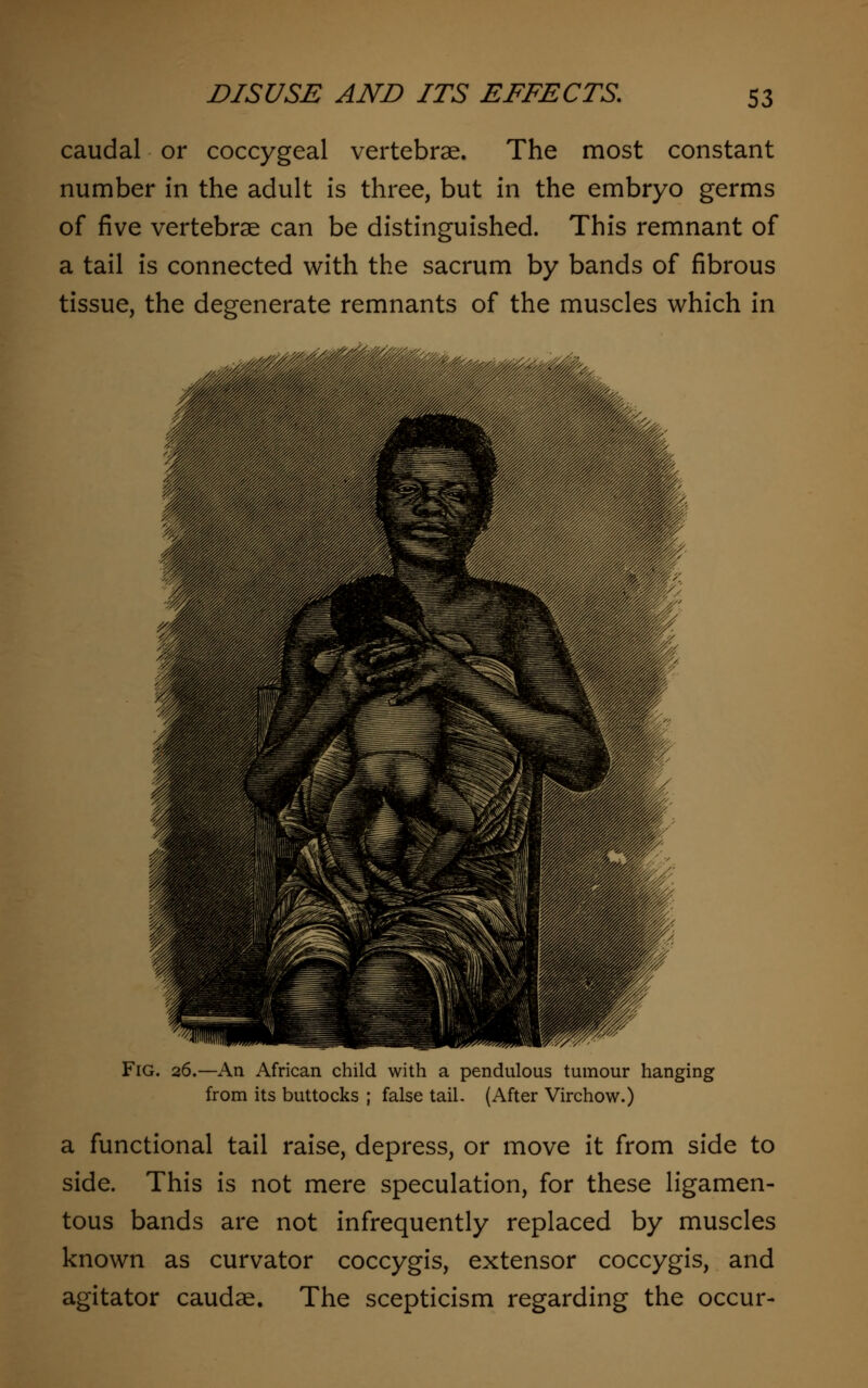 caudal or coccygeal vertebrae. The most constant number in the adult is three, but in the embryo germs of five vertebrae can be distinguished. This remnant of a tail is connected with the sacrum by bands of fibrous tissue, the degenerate remnants of the muscles which in Fig. 26.—An African child with a pendulous tumour hanging from its buttocks ; false tail. (After Virchow.) a functional tail raise, depress, or move it from side to side. This is not mere speculation, for these ligamen- tous bands are not infrequently replaced by muscles known as curvator coccygis, extensor coccygis, and agitator caudae. The scepticism regarding the occur-