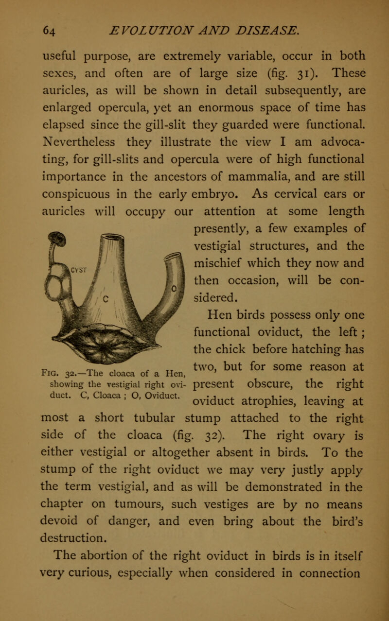 useful purpose, are extremely variable, occur in both sexes, and often are of large size (fig. 31). These auricles, as will be shown in detail subsequently, are enlarged opercula, yet an enormous space of time has elapsed since the gill-slit they guarded were functional. Nevertheless they illustrate the view I am advoca- ting, for gill-slits and opercula were of high functional importance in the ancestors of mammalia, and are still conspicuous in the early embryo. As cervical ears or auricles will occupy our attention at some length presently, a few examples of vestigial structures, and the mischief which they now and then occasion, will be con- sidered. Hen birds possess only one functional oviduct, the left; the chick before hatching has two, but for some reason at Fig. 32.—The cloaca of a Hen, showing the vestigial right ovi- present obscure, the right duct. C, Cloaca; O, Oviduct. • i . ■ • i oviduct atrophies, leaving at most a short tubular stump attached to the right side of the cloaca (fig. 32). The right ovary is either vestigial or altogether absent in birds. To the stump of the right oviduct we may very justly apply the term vestigial, and as will be demonstrated in the chapter on tumours, such vestiges are by no means devoid of danger, and even bring about the bird's destruction. The abortion of the right oviduct in birds is in itself very curious, especially when considered in connection