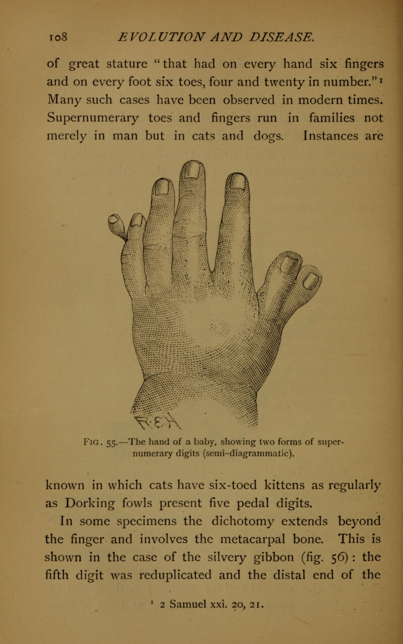 of great stature that had on every hand six fingers and on every foot six toes, four and twenty in number/'1 Many such cases have been observed in modern times. Supernumerary toes and fingers run in families not merely in man but in cats and dogs. Instances are Fig. 55.—The hand of a baby, showing two forms of super- numerary digits (semi-diagrammatic). known in which cats have six-toed kittens as regularly as Dorking fowls present five pedal digits. In some specimens the dichotomy extends beyond the finger and involves the metacarpal bone. This is shown in the case of the silvery gibbon (fig. 56) : the fifth digit was reduplicated and the distal end of the 1 2 Samuel xxi. 20, 21.