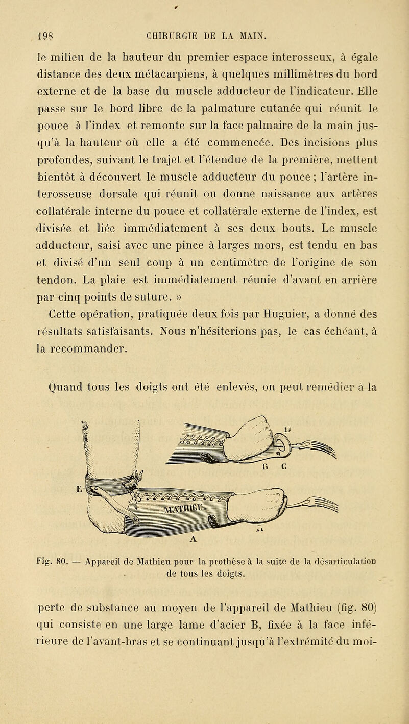 le milieu de la hauteur du premier espace interosseux, à égale distance des deux métacarpiens, à quelques millimètres du bord externe et de la base du muscle adducteur de l'indicateur. Elle passe sur le bord libre de la palmature cutanée qui réunit le pouce à l'index et remonte sur la face palmaire de la main jus- qu'à la hauteur où elle a été commencée. Des incisions plus profondes, suivant le trajet et l'étendue de la première, mettent bientôt à découvert le muscle adducteur du pouce ; l'artère in- terosseuse dorsale qui réunit ou donne naissance aux artères collatérale interne du pouce et collatérale externe de l'index, est divisée et liée immédiatement à ses deux bouts. Le muscle adducteur, saisi avec une pince à larges mors, est tendu en bas et divisé d'un seul coup à un centimètre de l'origine de son tendon. La plaie est immédiatement réunie d'avant en arrière par cinq points de suture. » Cette opération, pratiquée deux fois par Huguier, a donné des résultats satisfaisants. Nous n'hésiterions pas, le cas échéant, à la recommander. Quand tous les doigts ont été enlevés, on peut remédier à la Fig. 80. — Appareil de Mathieu pour la prothèse à la suite de la désarticulation de tous les doigts. perte de substance au moyen de l'appareil de Mathieu (fig. 80) qui consiste en une large lame d'acier B, fixée à la face infé- rieure de l'avant-bras et se continuant jusqu'à l'extrémité du moi-