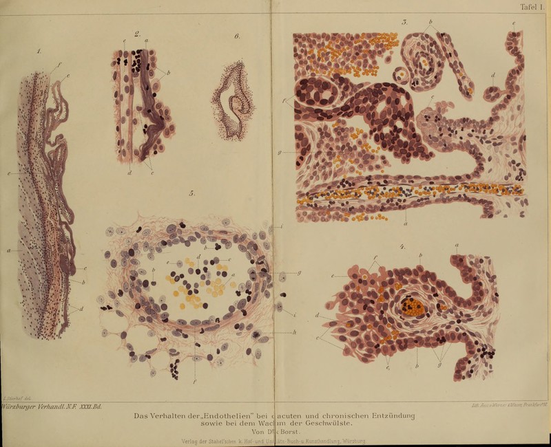 Tafel I. Wür/.biirger VerhajidL N.F. XXXI.Bd. Dcis VcM'haltcn (lci-.,Hndotlielieii bei c sowie bei dem Wac Von D' Verlag der Stahersclien k.Hot Iii/iAnst vh^erntr Ülfr.ter, FrankfiirfiM. acuten und chronischeti Entzüiuluncj im der Geschwülste. < Borst. n Wnr'-r.Mra