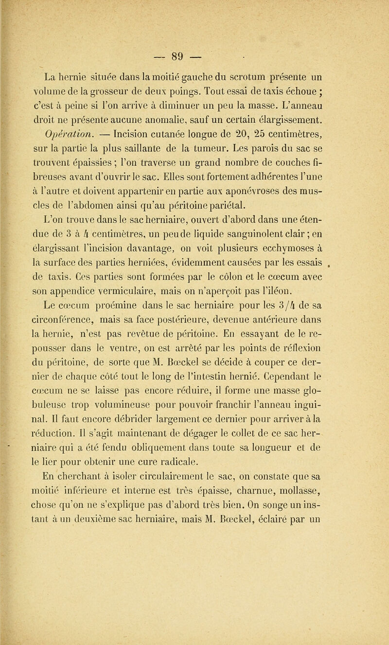 La hernie située dans la moitié gauche du scrotum présente un volume de la grosseur de deux poings. Tout essai de taxis échoue ; c'est à peine si Ton arrive à diminuer un peu la masse. L'anneau droit ne présente aucune anomalie, sauf un certain élargissement. Opération. — Incision cutanée longue de 20, 25 centimètres, sur la partie la plus saillante de la tumeur. Les parois du sac se trouvent épaissies ; l'on traverse un grand nombre de couches fi- breuses avant d'ouvrir le sac. Elles sont fortement adhérentes l'une à l'autre et doivent appartenir en partie aux aponévroses des mus- cles de l'abdomen ainsi qu'au péritoine pariétal. L'on trouve dans le sac herniaire, ouvert d'abord dans une éten- due de 3 à l\ centimètres, un peu de liquide sanguinolent clair ; en élargissant l'incision davantage, on voit plusieurs ecchymoses à la surface des parties herniées, évidemment causées par les essais . de taxis. Ces parties sont formées par le côlon et le cœcum avec son appendice vermiculaire, mais on n'aperçoit pas l'iléon. Le cœcum proémine dans le sac herniaire pour les 3/4 de sa circonférence, mais sa face postérieure, devenue antérieure dans la hernie, n'est pas revêtue de péritoine. En essayant de le re- pousser dans le ventre, on est arrêté par les points de réflexion du péritoine, de sorte que M. Bœckel se décide à couper ce der- nier de chaque côté tout le long de l'intestin hernie. Cependant le cœcum ne se laisse pas encore réduire, il forme une masse glo- buleuse trop volumineuse pour pouvoir franchir l'anneau ingui- nal. Il faut encore débrider largement ce dernier pour arriver à la réduction. Il s'agit maintenant de dégager le collet de ce sac her- niaire qui a été fendu obliquement dans toute sa longueur et de le lier pour obtenir une cure radicale. En cherchant à isoler circulairement le sac, on constate que sa moitié inférieure et interne est très épaisse, charnue, mollasse, chose qu'on ne s'explique pas d'abord très bien. On songe un ins- tant à un deuxième sac herniaire, mais M. Bœckel, éclairé par un