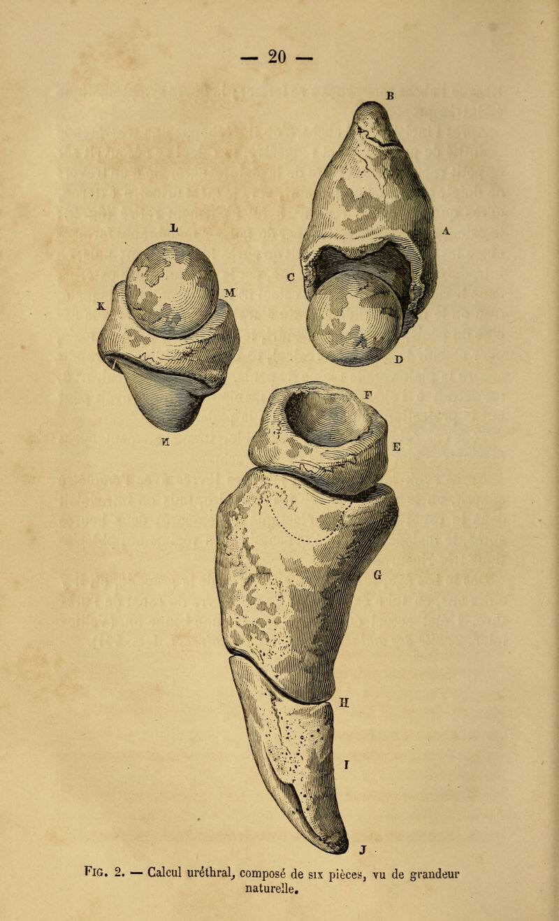Fig. 2. — Calcul uréthral, composé de six pièces, vu de grandeur naturelle.