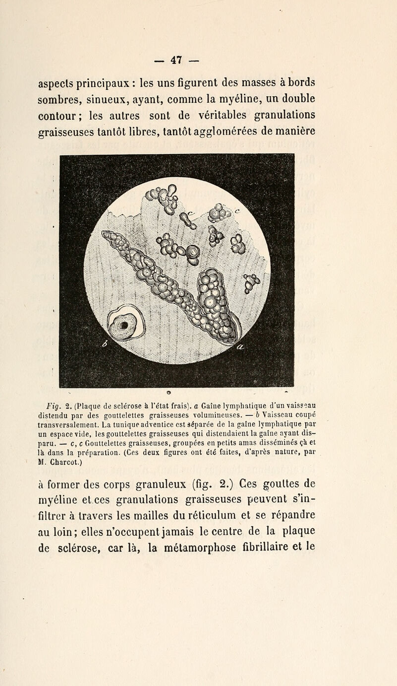 aspects principaux : les uns figurent des masses à bords sombres, sinueux, ayant, comme la myéline, un double contour; les autres sont de véritables granulations graisseuses tantôt libres, tantôt agglomérées de manière Fig. 2. (Plaque de sclérose à l'état frais), a Gaîne lymphatique d'un vaisseau distendu par des gouttelettes graisseuses volumineuses. — b Vaisseau coupé transversalement. La tunique adventice est séparée de la gaîne lymphatique par un espace vide, les gouttelettes graisseuses qui distendaient la gaîne ayant dis- paru. — c,c Gouttelettes graisseuses, groupées en petits amas disséminés çà et là dans la préparation. (Ces deux figures ont été faites, d'après nature, par M. Charcot.) à former des corps granuleux (fig. 2.) Ces gouttes de myéline et ces granulations graisseuses peuvent s'in- filtrer à travers les mailles du réticulum et se répandre au loin; elles n'occupent jamais le centre de la plaque de sclérose, car là, la métamorphose fibrillaire et le