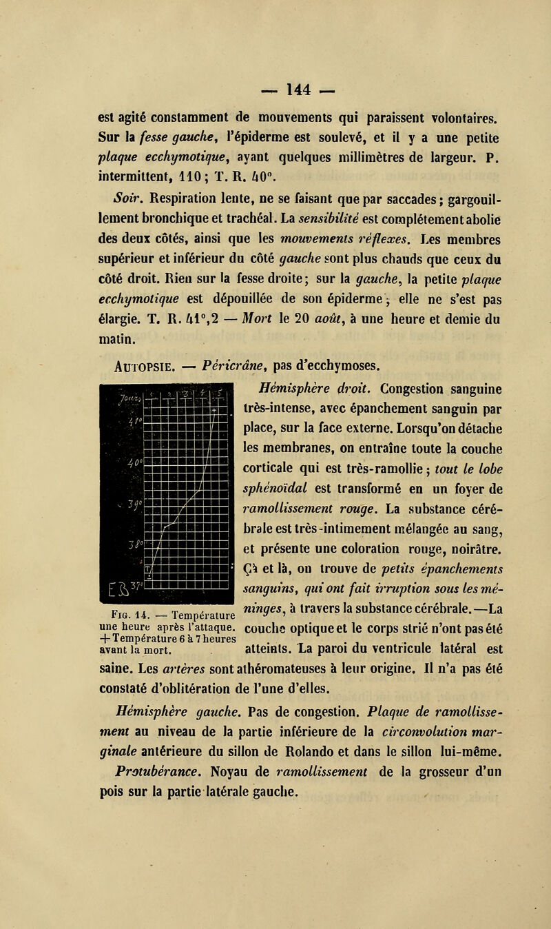 est agité constamment de mouvements qui paraissent volontaires. Sur la fesse gauche, l'épiderme est soulevé, et il y a une petite plaque ecchymotique, ayant quelques millimètres de largeur. P. intermittent, 110; T. R. ZiO. Soir. Respiration lente, ne se faisant que par saccades ; gargouil- lement bronchique et trachéal. La sensibilité est complètement abolie des deux côtés, ainsi que les mouvements réflexes. Les membres supérieur et inférieur du côté gauche sont plus chauds que ceux du côté droit. Rien sur la fesse droite; sur la gauche, la petite plaque ecchymolique est dépouillée de son épiderme \ elle ne s'est pas élargie. T. R. 41°,2 — Mort le 20 août, à une heure et demie du matin. Autopsie. — Péricrâne, pas d'ecchymoses. Hémisphère droit. Congestion sanguine très-intense, avec épanchement sanguin par I P'ace> sur k ^ace externe. Lorsqu'on détache I 'es membranes, on entraîne toute la couche corticale qui est très-ramollie ; tout le lobe I sphénoïdal est transformé en un foyer de ramollissement rouge. La substance céré- brale est très-intimement mélangée au sang, I et présente une coloration rouge, noirâtre. H ÇA et là, on trouve de petits épanchements sanguins, qui ont fait irruption sous les mé- ... , ,,, ninqes, à travers la substance cérébrale.—La riG. 14. — Température v ' une heure après l'attaque, coucha optique et le corps strié n'ont pas été + Température 6 k 7 heures . . , ... avant la mort. atteints. La paroi du ventricule latéral est saine. Les artères sont athéromateuses à leur origine. Il n'a pas été constaté d'oblitération de l'une d'elles. Hémisphère gauche. Pas de congestion. Plaque de ramollisse- ment au niveau de la partie inférieure de la circonvolution mar- ginale antérieure du sillon de Rolando et dans le sillon lui-même. Protubérance. Noyau de ramollissement de la grosseur d'un pois sur la partie latérale gauche.