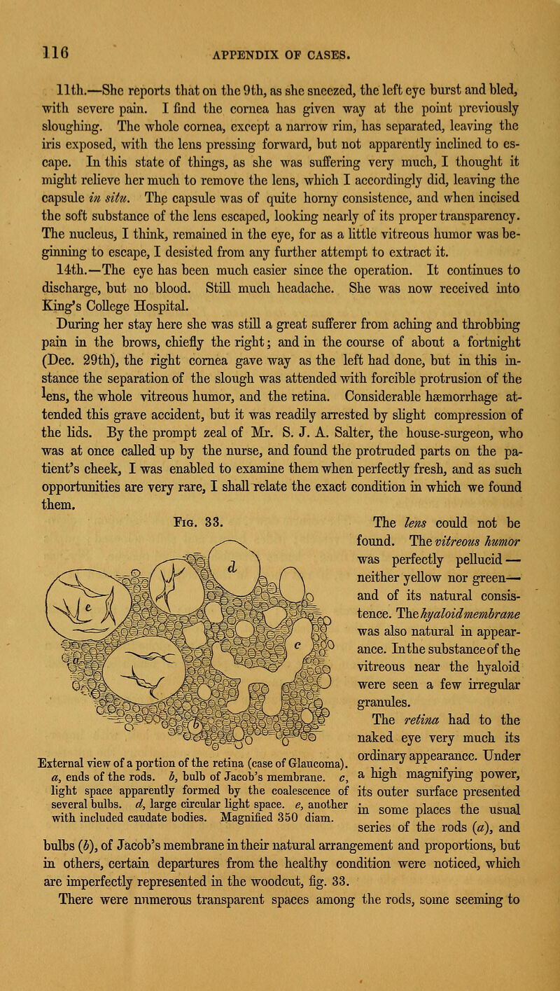 11th.—She reports that on the 9th, as she sneezed, the left eye burst and bled, with severe pain. I find the cornea has given way at the point previously sloughing. The whole cornea, except a narrow rim, has separated, leaving the iris exposed, with the lens pressing forward, but not apparently inclined to es- cape. In this state of things, as she was suffering very much, I thought it might relieve her much to remove the lens, which I accordingly did, leaving the capsule in situ. The capsule was of quite horny consistence, and when incised the soft substance of the lens escaped, looking nearly of its proper transparency. The nucleus, I think, remained in the eye, for as a little vitreous humor was be- ginning to escape, I desisted from any further attempt to extract it. 14th.—The eye has been much easier since the operation. It continues to discharge, but no blood. Still much headache. She was now received into King's College Hospital. During her stay here she was still a great sufferer from aching and throbbing pain in the brows, chiefly the right; and in the course of about a fortnight (Dec. 29th), the right cornea gave way as the left had done, but in this in- stance the separation of the slough was attended with forcible protrusion of the lens, the whole vitreous humor, and the retina. Considerable haemorrhage at- tended this grave accident, but it was readily arrested by slight compression of the lids. By the prompt zeal of Mr. S. J. A. Salter, the house-surgeon, who was at once called up by the nurse, and found the protruded parts on the pa- tient's cheek, I was enabled to examine them when perfectly fresh, and as such opportunities are very rare, I shall relate the exact condition in which we found them. Fig. 33. The lens could not be found. The vitreous humor was perfectly pellucid — neither yellow nor green— and of its natural consis- tence. The hyaloid membrane was also natural in appear- ance. Inthe substance of the vitreous near the hyaloid were seen a few irregular granules. The retina had to the naked eye very much its , , ..,-,, , ordinary appearance. Under External view of a portion ot the retina (case of Glaucoma). • rr a, ends of the rods, b, bulb of Jacob's membrane, c, a ^g magnifying power, light space apparently formed by the coalescence of its outer surface presented several bulbs ^ large circular light space ^another ^ some places the usual with included caudate bodies. Magnified 350 diam. . f , , , series ot the rods («), and bulbs (b), of Jacob's membrane in their natural arrangement and proportions, but in others, certain departures from the healthy condition were noticed, which are imperfectly represented in the woodcut, fig. 33. There were numerous transparent spaces among the rods, some seeming to