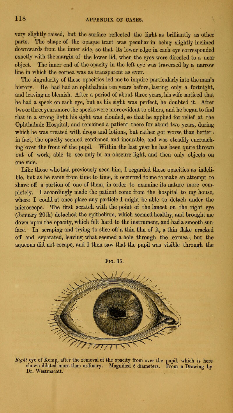 very slightly raised, but the surface reflected the light as brilliantly as other parts. The shape of the opaque tract was peculiar in being slightly inclined downwards from the inner side, so that its lower edge in each eye corresponded exactly with the margin of the lower lid, when the eyes were directed to a near object. The inner end of the opacity in the left eye was traversed by a narrow line in which the cornea was as transparent as ever. The singularity of these opacities led me to inquire particularly into the man's history. He had had an ophthalmia ten years before, lasting only a fortnight, and leaving no blemish. After a period of about three years, his wife noticed that he had a speck on each eye, but as his sight was perfect, he doubted it. After twoorthreeyearsmorethe specks were moreevident to others, and he began to find that in a strong light his sight was clouded, so that he applied for relief at the Ophthalmic Hospital, and remained a patient there for about two years, during which he was treated with drops and lotions, but rather got worse than better: in fact, the opacity seemed confirmed and incurable, and was steadily encroach- ing over the front of the pupil. Within the last year he has been quite thrown out of work, able to see only in an obscure light, and then only objects on one side. Like those who had previously seen him, I regarded these opacities as indeli- ble, but as he came from time to time, it occurred to me to make an attempt to shave off a portion of one of them, in order to examine its nature more com- pletely. I accordingly made the patient come from the hospital to my house, where I could at once place any particle I might be able to detach under the microscope. The first scratch with the point of the lancet on the right eye (January 20th) detached the epithelium, which seemed healthy, and brought me down upon the opacity, which felt hard to the instrument, and had a smooth sur- face. In scraping and trying to slice off a thin film of it, a thin flake cracked off and separated, leaving what seemed a hole through the cornea; but the aqueous did not escape, and I then saw that the pupil was visible through the Eight eye of Kemp, after the removal of the opacity from over the pupil, which is here shown dilated more than ordinary. Magnified 2 diameters. From a Drawing by Dr. Westmacott.