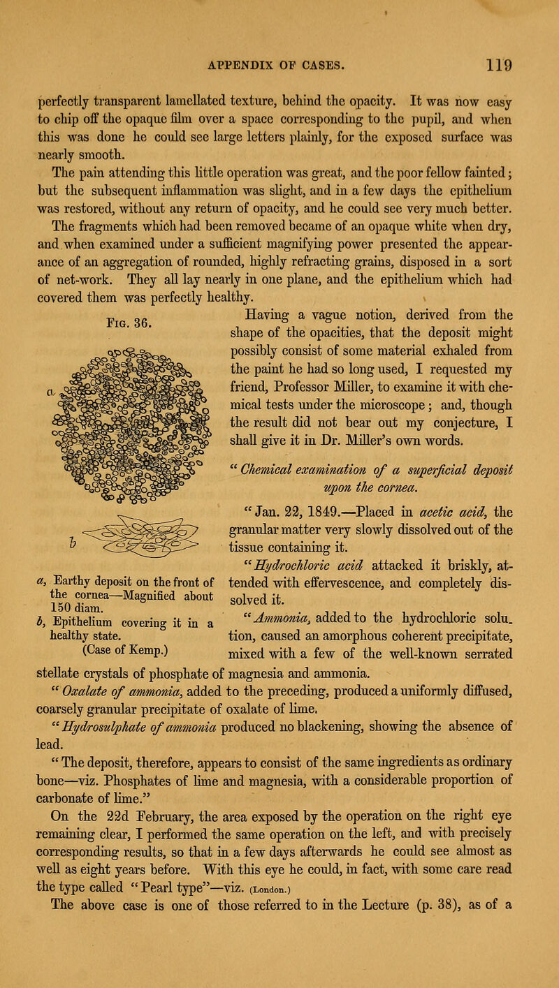 Fig. 36. perfectly transparent laraellated texture, behind the opacity. It was now easy to chip off the opaque film over a space corresponding to the pupil, and when this was done he could see large letters plainly, for the exposed surface was nearly smooth. The pain attending this little operation was great, and the poor fellow fainted; but the subsequent inflammation was slight, and in a few days the epithelium was restored, without any return of opacity, and he could see very much better. The fragments winch had been removed became of an opaque white when dry, and when examined under a sufficient magnifying power presented the appear- ance of an aggregation of rounded, highly refracting grains, disposed in a sort of net-work. They all lay nearly in one plane, and the epithelium which had covered them was perfectly healthy. Having a vague notion, derived from the shape of the opacities, that the deposit might possibly consist of some material exhaled from the paint he had so long used, I requested my friend, Professor Miller, to examine it with che- mical tests under the microscope ; and, though the result did not bear out my conjecture, I shall give it in Dr. Miller's own words.  Chemical examination of a superficial deposit upon the cornea.  Jan. 22, 1849.—Placed in acetic acid, the granular matter very slowly dissolved out of the tissue containing it. Hydrochloric acid attacked it briskly, at- tended with effervescence, and completely dis- solved it. Ammonia, added to the hydrochloric solu. tion, caused an amorphous coherent precipitate, mixed with a few of the well-known serrated stellate crystals of phosphate of magnesia and ammonia.  Oxalate of ammonia, added to the preceding, produced a uniformly diffused, coarsely granular precipitate of oxalate of lime.  Hydrosulphate of ammonia produced no blackening, showing the absence of lead.  The deposit, therefore, appears to consist of the same ingredients as ordinary bone—viz. Phosphates of lime and magnesia, with a considerable proportion of carbonate of lime. On the 22d February, the area exposed by the operation on the right eye remaining clear, I performed the same operation on the left, and with precisely corresponding results, so that in a few days afterwards he could see almost as well as eight years before. With this eye he could, in fact, with some care read the type called  Pearl type—viz. (London.) The above case is one of those referred to in the Lecture (p. 38), as of a a, Earthy deposit on the front of the cornea—Magnified about 150 diam. b, Epithelium covering it in a healthy state. (Case of Kemp.)