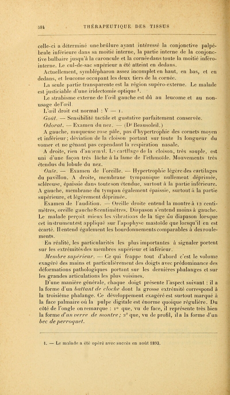 celle-ci a déterminé une brûlure ayant intéressé la conjonctive palpé- brale inférieure dans sa moitié interne, la partie interne de la conjonc- tive bulbaire jusqu'à la caroncule et la cornéedans toute la moitié inféro- interne. Le cul-de-sac supérieur a été atteint en dedans. Actuellement, symblépharon assez incomplet en haut, en bas, et en dedans, et leucome occupant les deux tiers de la cornée. La seule partie transparente est la région supéro-externe. Le malade est justiciable d'une iridectomie optique K Le strabisme externe de l'œil g-auche est dû au leucome et au non- usag'e de l'œil. L'œil droit est normal : V — i. Goût. — Sensibilité tactile et g-ustative parfaitement conservée. Odorat. —Examen du nez. — (D' Beausoleil.) A g-auche, muqueuse rose pâle, pas d'hypertrophie des cornets moyen et inférieur; déviation de la cloison portant sur toute la longueur du vomer et ne g^ênant pas cependant la respiration nasale. A droite, rien d'anornnl. Lt cartHno-e de la cloison, très souple, est uni d'une façon très lâche à la lame de l'ethmoïde. Mouvements très étendus du lobule du nez. Ouïe. — Examen de l'oreille. — H3'pertrophie lég-èredes cartilag-es du pavillon. A droite, membrane tympanique nullement déprimée, scléreuse, épaissie dans touteson étendue, surtout à la partie inférieure. A g-auche, membrane du tympan ég-alement épai.ssie, surtout à la partie supérieure, et lég-èrement dépi'imée. Examen de l'audition. — Oreille droite entend lamontreà 12 centi- mètres, oreille gaucheScentimètres, Diapason s'entend moins à g-auche. Le malade perçoit mieux les vibrations de la tig-e du diapason lorsque cet instrumentest appliqué sur l'apophyse mastoïde que lorsqu'il en est écarté. Il entend ég-alement les bourdonnements comparables à des roule- ments. En réalité, les particularités les plus importantes à sig-naler portent sur les extrémités des membres supérieur et inférieur. Membre supérieur. — Ce qui frappe; tout d'abord c'est le volume exag-éré des mains et particulièrement des doig-ts avec prédominance des déformations patholog-iques portant sur les dernières phalang'es et sur les g-randes articulations les plus voisines. D'une manière g-énérale, chaque doig-t présente l'aspect suivant : il a la forme d'un battant de cloche dont la grosse extrémité correspond à la troisième phalang-e. Ce développement exag-éré est surtout marqué à la face palmaire où la pulpe dig-itale est énorme quoique rég-ulière. Du côté de l'ong-le on remarque : lo que, vu de face, il représente très bien la forme d'un verre de montre ; 2 que, vu de profil, il a la forme d'un bec de perroquet. 1. — Le malade a été opéré avec succès en août 1803.