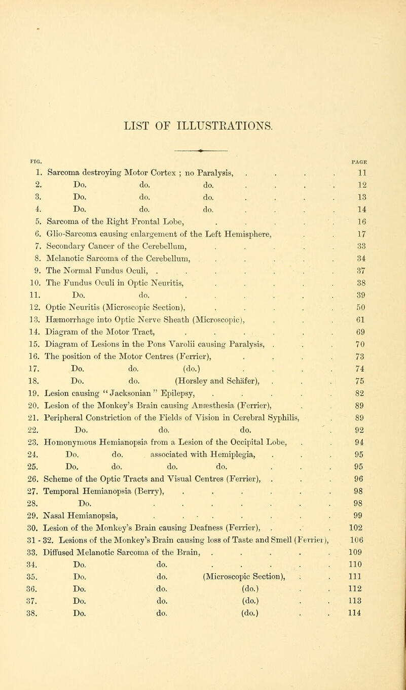 FIG. 1. Sarcoma destroying Motor Cortex ; no Paralysis, 2. Do. do. do. 3. Do. do. do. 4. Do. do. do. 5. Sarcoma of the Right Frontal Lobe, 6. Glio-Sarcoma causing enlargement of the Left Hemisphere, 7. Secondary Cancer of the Cerebellum, 8. Melanotic Sarcoma of the Cerebellum, 9. The Normal Fundus Oculi, .... 10. The Fundus Oculi in Optic Neuritis, 11. Do. do. ... 12. Optic Neuritis (Microscopic Section), 13. Haemorrhage into Optic Nerve Sheath (Microscopic), 14. Diagram of the Motor Tract, 15. Diagram of Lesions in the Pons Varolii causing Paralysis, 16. The position of the Motor Centres (Ferrier), 17. Do. do. (do.) 18. Do. do. (Horsley and Schafer), 19. Lesion causing  Jacksonian  Epilepsy, 20. Lesion of the Monkey's Brain causing Anaesthesia (Ferrier), 21. Peripheral Constriction of the Fields of Vision in Cerebral Syphilis, 22. Do. do. do. 23. Homonymous Hemianopsia, from a Lesion of the Occipital Lobe, 24. Do. do. associated with Hemiplegia, 25. Do. do. do. do. 26. Scheme of the Optic Tracts and Visual Centres (Ferrier), 27. Temporal Hemianopsia (Berry), .... 28. Do. .... 29. Nasal Hemianopsia, . . 30. Lesion of the Monkey's Brain causing Deafness (Ferrier), 31 - 32. Lesions of the Monkey's Brain causing loss of Taste and Smell (F 33. Diffused Melanotic Sarcoma of the Brain, 34. Do. do. ... 35. Do. do. (Microscopic Section), 36. Do. do. (do.) 37. Do. do. (do.) erriei), PAGE 11 12 13 14 16 17 33 34 37 38 39 50 61 69 70 73 74 75 82 89 89 92 94 95 95 96 102 106 109 110 111 112 113
