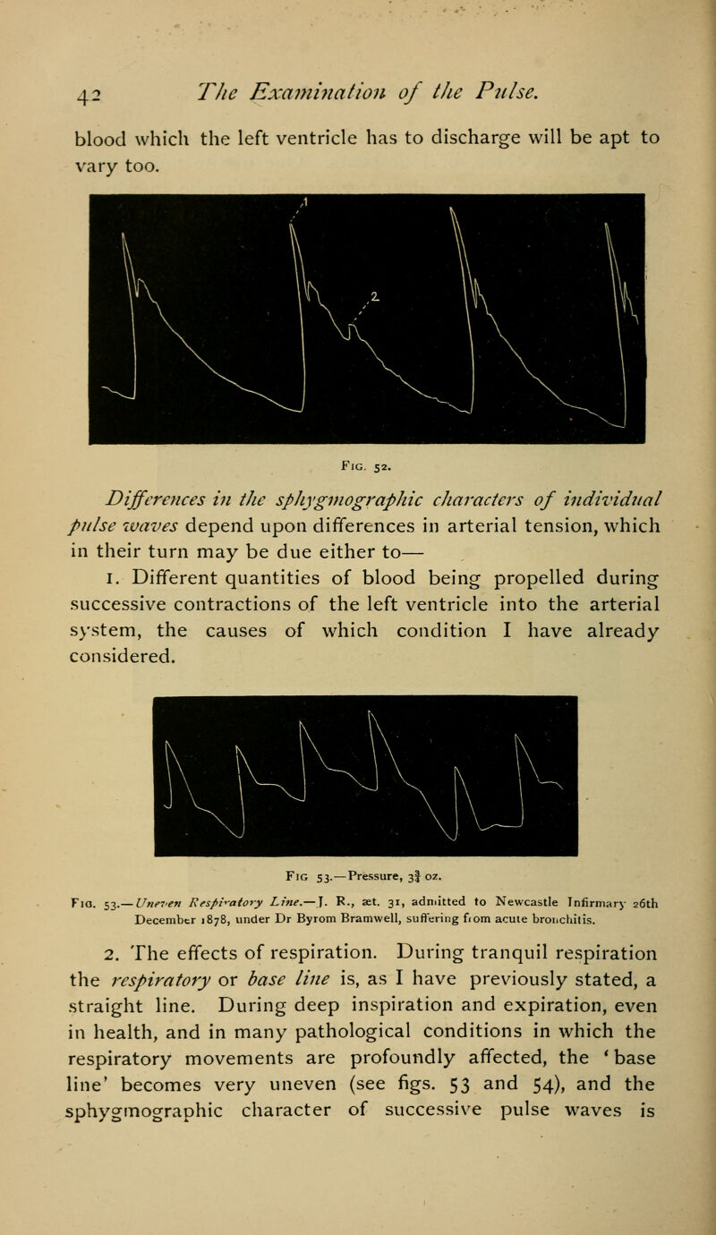 blood which the left ventricle has to discharge will be apt to vary too. Fig. 52. Differences in the spJiygmographic cJiaraciers of individual pulse ivaves depend upon differences in arterial tension, which in their turn may be due either to— I. Different quantities of blood being propelled during successive contractions of the left ventricle into the arterial system, the causes of which condition I have already considered. Fig 53. — Pressure, 3I oz. Fig. II.—Uneven Respi->-atory Line.—]. K., aet. 31, adniitted to Newcastle Infirmary 26th December 1878, under Dr Byrom Bramwell, suflering fiom acute bronchitis. 2. The effects of respiration. During tranquil respiration the respiratory or base line is, as I have previously stated, a straight line. During deep inspiration and expiration, even in health, and in many pathological conditions in which the respiratory movements are profoundly affected, the * base line' becomes very uneven (see figs. 53 and 54), and the sphygmographic character of successive pulse waves is