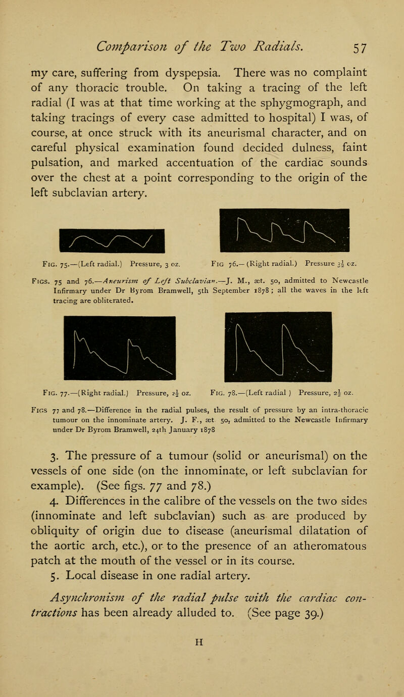 my care, sufifering from dyspepsia. There was no complaint of any thoracic trouble. On taking a tracing of the left radial (I was at that time working at the sphygmograph, and taking tracings of every case admitted to hospital) I was, of course, at once struck with its aneurismal character, and on careful physical examination found decided dulness, faint pulsation, and marked accentuation of the cardiac sounds over the chest at a point corresponding to the origin of the left subclavian artery. Fig. 75.—(Left radial.) Pressure, 3 oz. Fig 76.—(Right radial.) Pressure 3^ cz. Figs. 75 and 76. — Aneurism of Left Subclaviai^.—J. M., set, 50, admitted to Newcastle Infirmary under Dr Byrom Bramwell, 5th September 1878 ; all the waves in the left tracing are oblittrated. Fig. 77.—(Right radial.) Pressure, 2\ oz. Fig. 78.—(Left radial ) Pressure, 2.\ oz. Figs 77 and 78.—Difference in the radial pulses, the result of pressure by an intra-thoracic tumour on the innominate artery. J. F., set 50, admitted to the Newcastle Infirmary under Dr Byrom Bramwell, 24th January 1878 3. The pressure of a tumour (solid or aneurismal) on the vessels of one side (on the innominate, or left subclavian for example). (See figs. 77 and jZ?) 4. Differences in the calibre of the vessels on the two sides (innominate and left subclavian) such as are produced by obliquity of origin due to disease (aneurismal dilatation of the aortic arch, etc.), or to the presence of an atheromatous patch at the mouth of the vessel or in its course. 5. Local disease in one radial artery. Asynchronism of the radial pidse with the cardiac con- tractions has been already alluded to. (See page 39.) H