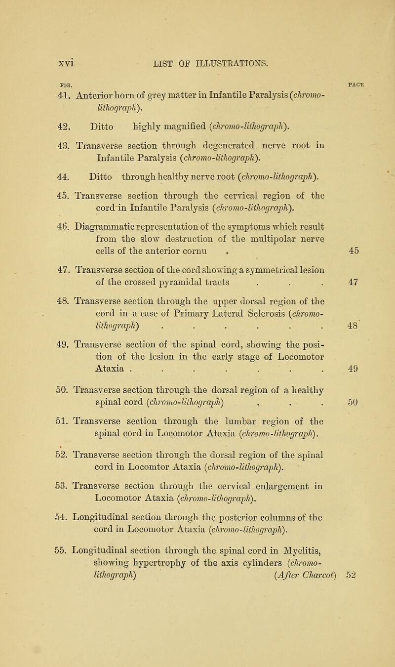 FIG. PAC1 41. Anterior horn of grey matter in Infantile Paralysis (chromo- lithograph). 42. Ditto highly magnified (cJiromo-lithograph). 43. Transverse section through degenerated nerve root in Infantile Paralysis (chromo-lithograph). 44. Ditto through healthy nerve root (chromo-lithograph). 45. Transverse section through the cervical region of the cord'in Infantile Paralysis (chromo-lithograph). 46. Diagrammatic representation of the symptoms which result from the slow destruction of the multipolar nerve cells of the anterior cornu . 45 47. Transverse section of the cord showing a symmetrical lesion of the crossed pyramidal tracts ... 47 48. Transverse section through the upper dorsal region of the cord in a case of Primary Lateral Sclerosis (chromo- lithograph) ...... 48 49. Transverse section of the spinal cord, showing the posi- tion of the lesion in the early stage of Locomotor Ataxia ....... 49 50. Transverse section through the dorsal region of a healthy spinal cord {chromo-lithograph) ... 50 51. Transverse section through the lumbar region of the spinal cord in Locomotor Ataxia (chromo-lithograph). 52. Transverse section through the dorsal region of the spinal cord in Locomtor Ataxia (chromo-lithograph). 53. Transverse section through the cervical enlargement in Locomotor Ataxia (chromo-lithograph). 54. Longitudinal section through the posterior columns of the cord in Locomotor Ataxia (chromo-lithograph). 55. Longitudinal section through the spinal cord in Myelitis, showing hypertrophy of the axis cylinders (chromo- lithograph) (After Charcot) 52