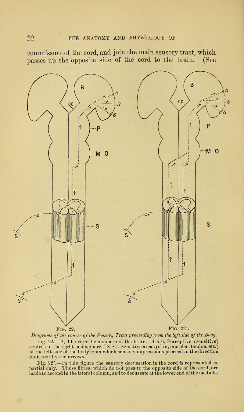 commissure of the cord, and join the main sensory tract, which passes up the opposite side of the cord to the brain. (See Pig. 22. Fig. 22'. Diagrams of the course of the Sensory Tract proceeding from the leftside of the Body. Pig. 22.—B, The right hemisphere of the brain. 4 5 6, Perceptive (sensitive) centres in the right hemisphere. S S.', Sensitive areas (skin, muscles, tendon, etc.) of the left side of the body from which sensory impressions proceed in the direction indicated by the arrows. Fig. 22'.—In this figure the sensory decussation in the cord is represented as partial only. Those fibres, which do not pass to the opposite side of the cord, are made to ascend in the lateral column, and to decussate at the lower end of the medulla.