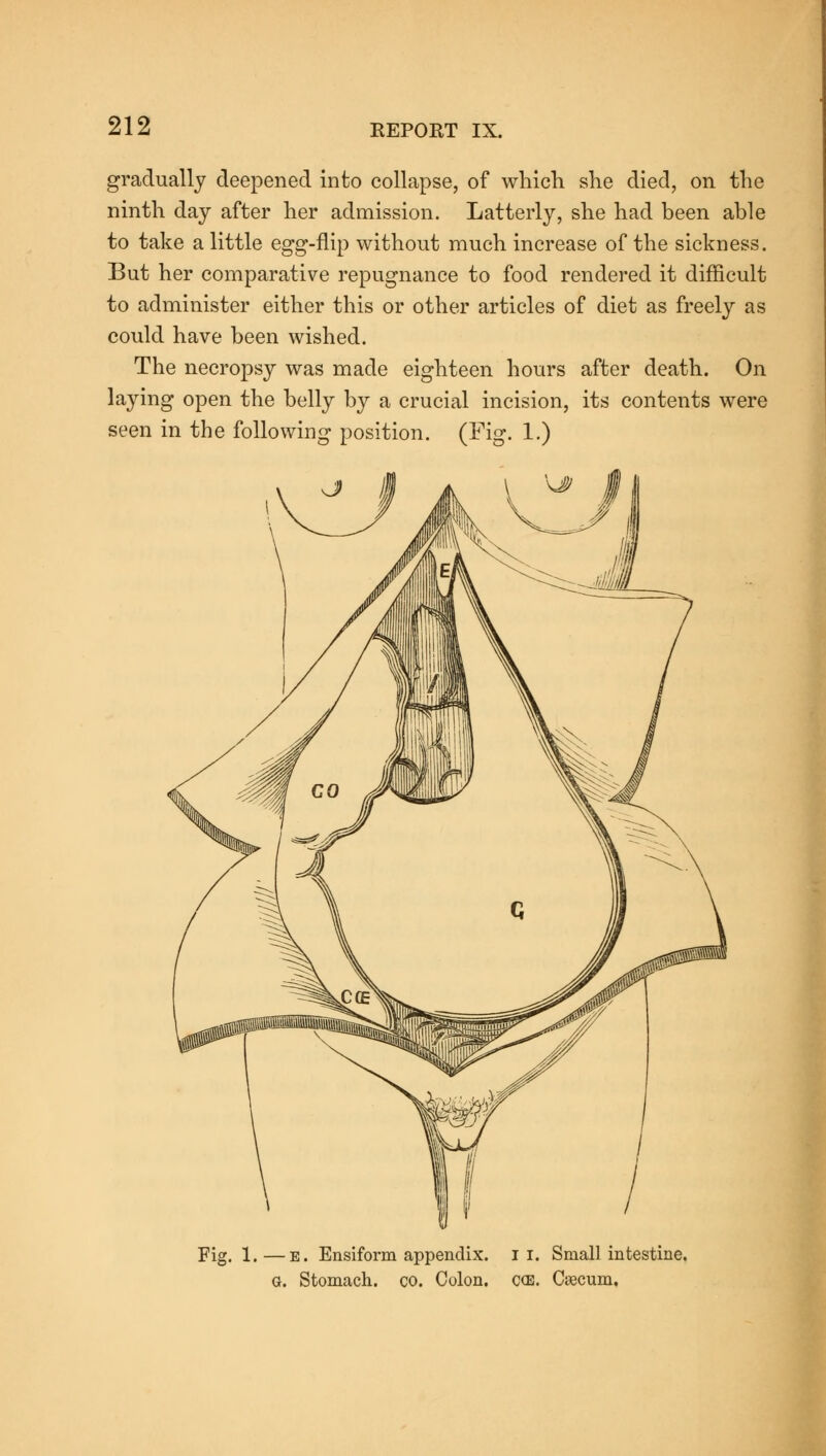 gradually deepened into collapse, of which she died, on the ninth day after her admission. Latterly, she had been able to take a little egg-flip without much increase of the sickness. But her comparative repugnance to food rendered it difficult to administer either this or other articles of diet as freely as could have been wished. The necropsy was made eighteen hours after death. On laying open the belly by a crucial incision, its contents were seen in the following position. (Fig. 1.) Fig. 1.—e. Ensiform appendix. II. Small intestine. G. Stomach, co. Colon. c<e. Caecum.