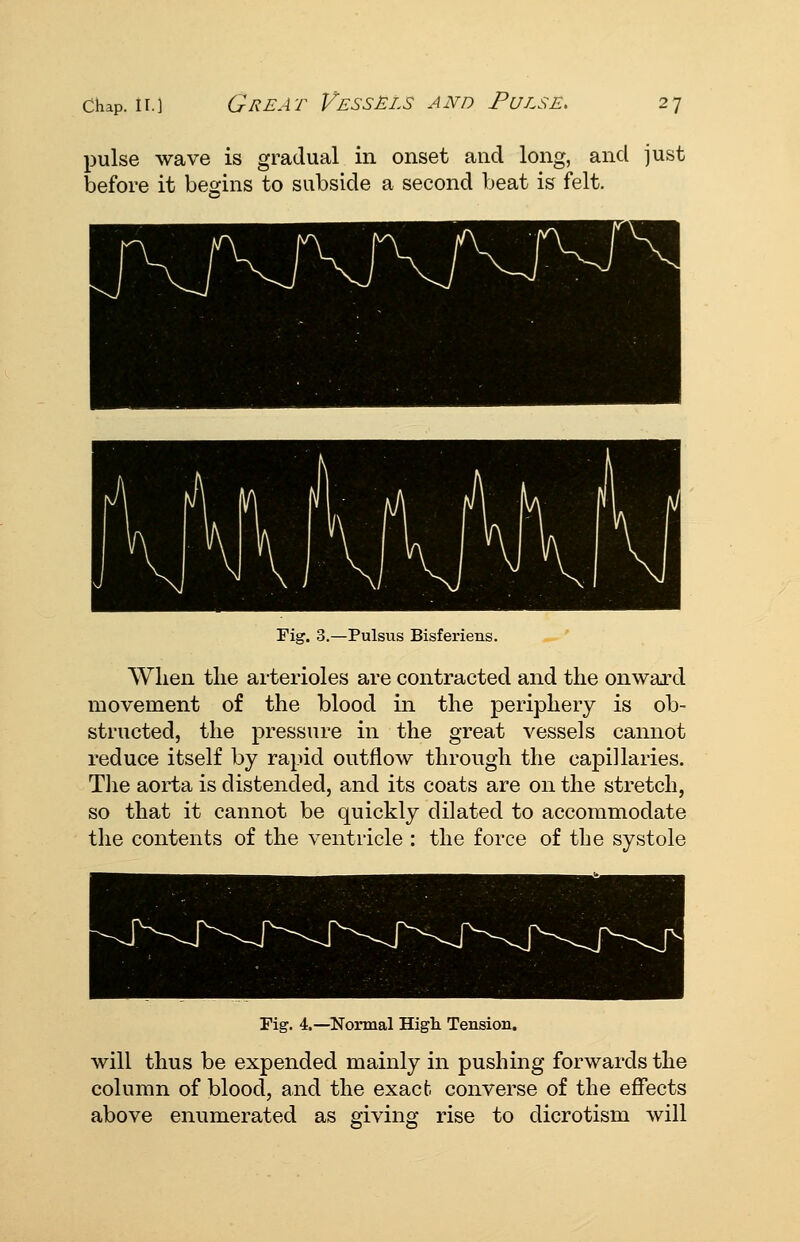 pulse wave is gradual in onset and long, and just i3efore it besins to subside a second beat is felt. Fig. 3.—Pulsus Bisferiens. Wlien tlie arterioles are contracted and the onwaixl movement of the blood in the periphery is ob- structed, the pressure in the great vessels cannot reduce itself by rapid outflow through the capillaries. Tlie aorta is distended, and its coats are on the stretch, so that it cannot be quickly dilated to accommodate the contents of the ventricle : the force of the systole Fig. 4.—Normal High Tension. will thus be expended mainly in pushing forwards the column of blood, and the exact converse of the effects above enumerated as giving rise to dicrotism will