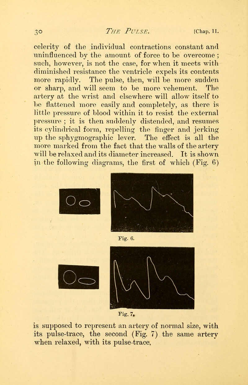celerity of tlie individual contractions constant and uninfluenced by the amount of force to be overcome ; such, however, is not the case, for when it meets with diminished resistance the ventricle expels its contents more rapidly. The pulse, then, will be more sudden or sharp, and will seem to be more vehement. The artery at the wrist and elsewhere will allow itself to be flattened more easily and completely, as there is little pressure of blood within it to resist the external pressure ; it is then suddenly distended, and resumes its cylindrical form, repelling the finger and jerking up the sphygmographic lever. The eflect is all the more marked from the fact that the walls of the artery will be relaxed and its diameter increased. It is shown in the following diagrams, the first of which (Fig. 6) is supposed to represent an artery of normal size, with its pulse-trace, the second (Fig. 7) the same artery when relaxed, with its pulse-trace.