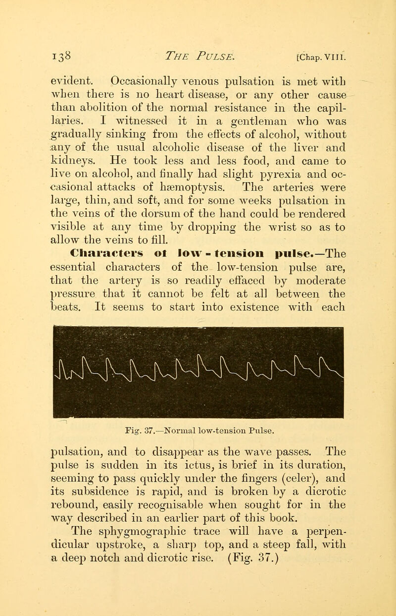 evident. Occasionally venous pulsation is met with when there is no heart disease, or any other cause than abolition of the normal resistance in the capil- laries. I witnessed it in a gentleman who was gradually sinking from the effects of alcohol, without :any of the usual alcoholic disease of the liver and kidneys. He took less and less food, and came to live on alcohol, and finally had slight pyrexia and oc- casional attacks of haemoptysis. The arteries were large, thin, and soft, and for some Aveeks pulsation in the veins of the dorsum of the hand could be rendered visible at any time by dropping the wrist so as to allow the veins to fill. Characters ot low - teiisioo piilse.—The essential characters of the low-tension pulse are, that the artery is so readily effaced by moderate pressure that it cannot be felt at all between the beats. It seems to start into existence with each Fig. 37.—Normal low-tension Pnlse. pulsation, and to disappear as the wave passes. The pulse is sudden in its ictus^ is brief in its duration, seeming to pass quickly under the fingers (celer), and its subsidence is rapid, and is broken by a dicrotic rebound, easily recognisable when sought for in the way described in an earlier part of this book. The sphygmographic trace will have a perpen- dicular upstroke, a sharp top, and a steep fall, with a deep notch and dicrotic rise. (Fig. 37.)