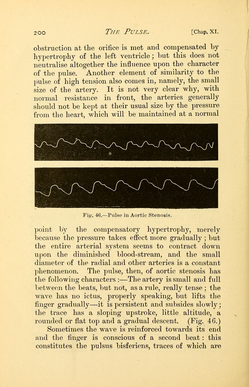 obstruction at the orifice is met and compensated by hypertrophy of the left ventricle; but this does not neutralise altogether the influence upon the character of the pulse. Another element of similarity to the pulse of high tension also comes in, namely, the small size of the artery. It is not very clear why, with normal resistance in front, the arteries generally should not be kept at their usual size by the pressure from the heart, which will be maintained at a normal Fig. 46.—Pulse in Aortic Stenosis. point by the compensatory hypertrophy, merely because the pressure takes effect more gradually ; but the entire arterial system seems to contract down upon the diminished blood-stream, and the small diameter of the radial and other arteries is a constant phenomenon. The pulse, then, of aortic stenosis has the following characters :—The artery is small and full between the beats, but not, as a rule, really tense ; the wave has no ictus, properly speaking, but lifts the finger gradually—it is persistent and subsides slowly; the trace has a sloping upstroke, little altitude, a rounded or flat top and a gradual descent. (Fig. 46.) Sometimes the wave is reinforced towards its end and the finger is conscious of a second beat: this constitutes the pulsus bisferiens, traces of which are