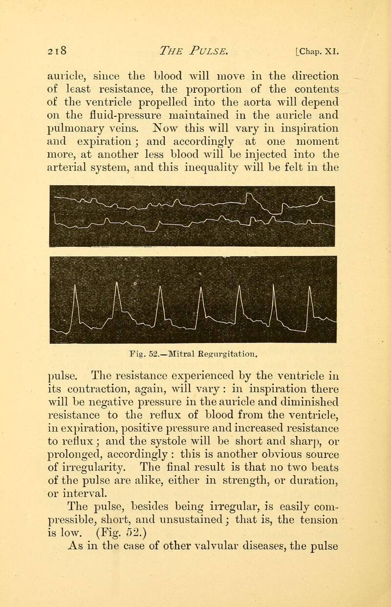 auricle, since the blood will move in the direction of least resistance, the proportion of the contents of the ventricle propelled into the aorta will depend on the fluid-pressure maintained in the auricle and pulmonary veins. Now this will vary in inspiration and expiration; and accordingly at one moment more, at another less blood will be injected into the arterial system, and this inequality will be felt in the Fig. 52.—Mitral Eeg-nrgitatiou. pulse. The resistance experienced by the ventricle in its contraction, again, will vary : in inspiration there will be negative pressure in the auricle and diminished resistance to the reflux of blood from the ventricle, in expiration, positive pressure and increased resistance to rellux; and the systole will be short and sharp, or prolonged, accordingly : this is another obvious source of irregularity. The final result is that no two beats of the pulse are alike, either in strength, or duration, or interval. The pulse, besides being irregular, is easily com- pressible^ short, and unsustained j that is, the tension is low. (Fig. 552.) As in the case of other valvular diseases, the pulse