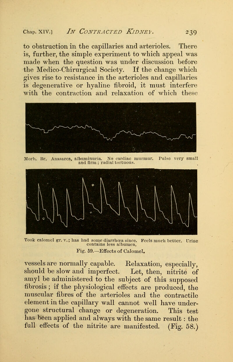 to obstruction in the capillaries and arterioles. There is, further, the simple experiment to which appeal was made when the question was under discussion before the Medico-Chirurgical Society. If the change which gives rise to resistance in the arterioles and capillaries is degenerative or hyaline fibroid, it must interfere with the contraction and relaxation of which these Morb. Br. Anasarca, albuminuria. No cardiac murmur. Pulse very small and Arm ; radial tortuous. Took calomel gr. v.; has liad some diarrhoea since. Feels much better. Urine contains less albumen. Fig. 59.—Effects of Calomel. vessels are normally capable. Relaxation, especially, should be slow and imperfect. Let, then, nitrite of amyl be administered to the subject of this supposed fibrosis ; if the physiological effects are produced, the muscular fibres of the arterioles and the contractile element in the capillary wall cannot well have under- gone structural change or degeneration. This test has been applied and always with the same result : the full effects of the nitrite are manifested. (Fig. 58.)