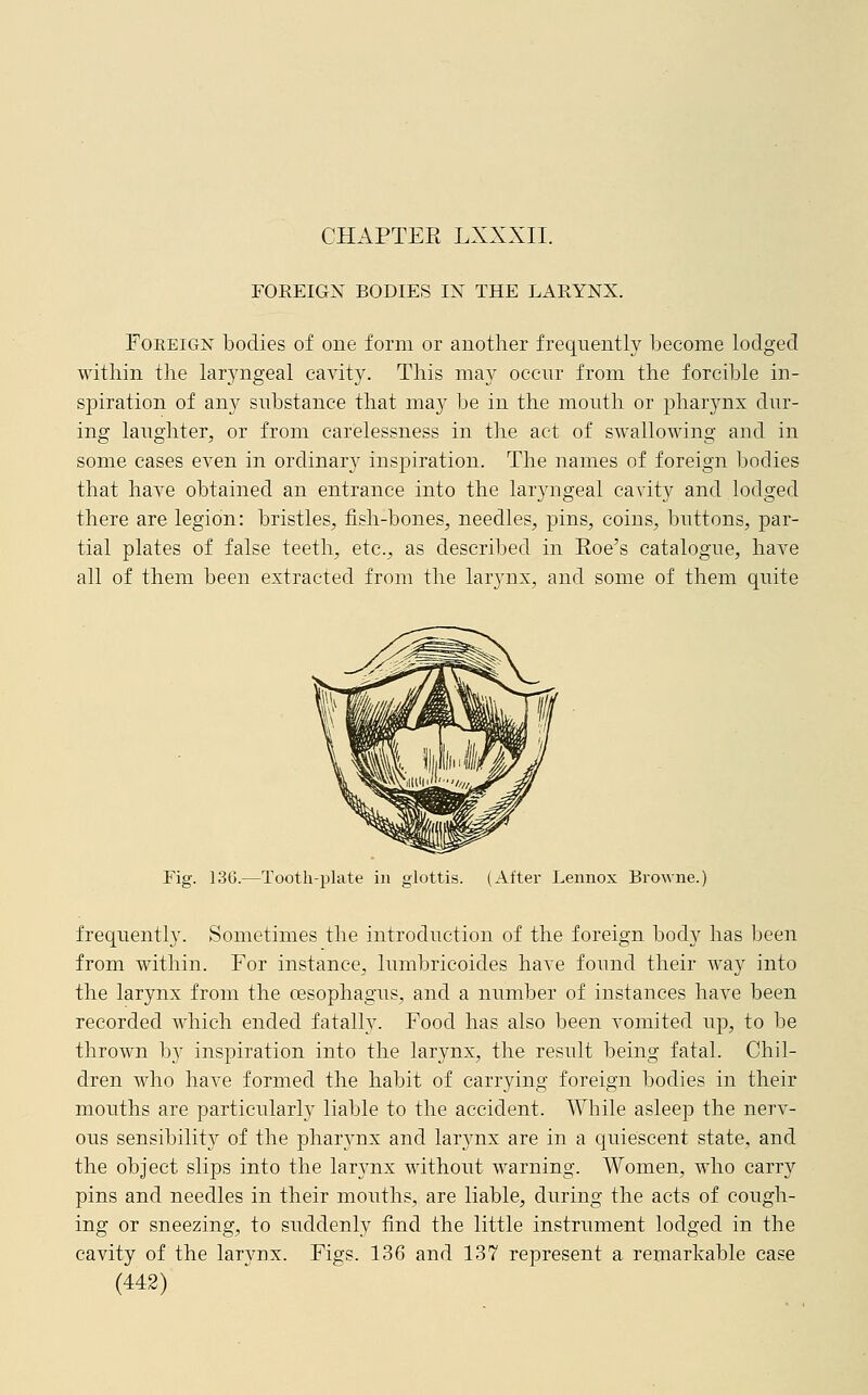 FOREIGN BODIES IN THE LARYNX. Foreign bodies of one form or another frequently become lodged within the laryngeal cavity. This may occur from the forcible in- spiration of airy substance that ma}>- be in the mouth or pharynx dur- ing laughter, or from carelessness in the act of swallowing and in some cases even in ordinary inspiration. The names of foreign bodies that have obtained an entrance into the laryngeal cavity and lodged there are legion: bristles, fish-bones, needles, pins, coins, buttons, par- tial plates of false teeth, etc., as described in Eoe's catalogue, have all of them been extracted from the larynx, and some of them quite Fig. 136.—Tooth-plate in glottis. (After Lennox Browne.) frequently. Sometimes the introduction of the foreign body has been from within. For instance, lumbricoides have found their way into the larynx from the oesophagus, and a number of instances have been recorded which ended fatally. Food has also been vomited up, to be thrown by inspiration into the larynx, the result being fatal. Chil- dren who have formed the habit of carrying foreign bodies in their mouths are particularly liable to the accident. While asleep the nerv- ous sensibility of the pharynx and larynx are in a quiescent state, and the object slips into the larynx without warning. Women, who carry pins and needles in their mouths, are liable, during the acts of cough- ing or sneezing, to suddenly find the little instrument lodged in the cavity of the larynx. Figs. 136 and 137 represent a remarkable case