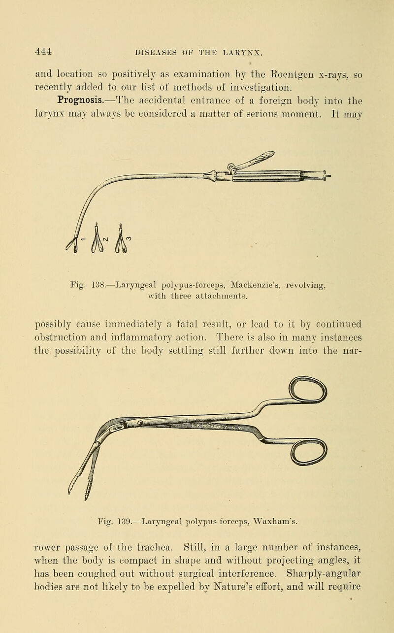 and location so positively as examination by the Roentgen x-rays, so recently added to our list of methods of investigation. Prognosis.—The accidental entrance of a foreign body into the larynx may always be considered a matter of serious moment. It may Fig. 138.—Laryngeal polypus-forceps, Mackenzie's, revolving, with three attachments. possibly cause immediately a fatal result, or lead to it by continued obstruction and inflammatory action. There is also in many instances the possibility of the body settling still farther down into the nar- Fig. 139.—Laryngeal polypus-forceps, Waxham's. rower passage of the trachea. Still, in a large number of instances, when the body is compact in shape and without projecting angles, it has been coughed out without surgical interference. Sharply-angular bodies are not likely to be expelled by Nature's effort, and will require