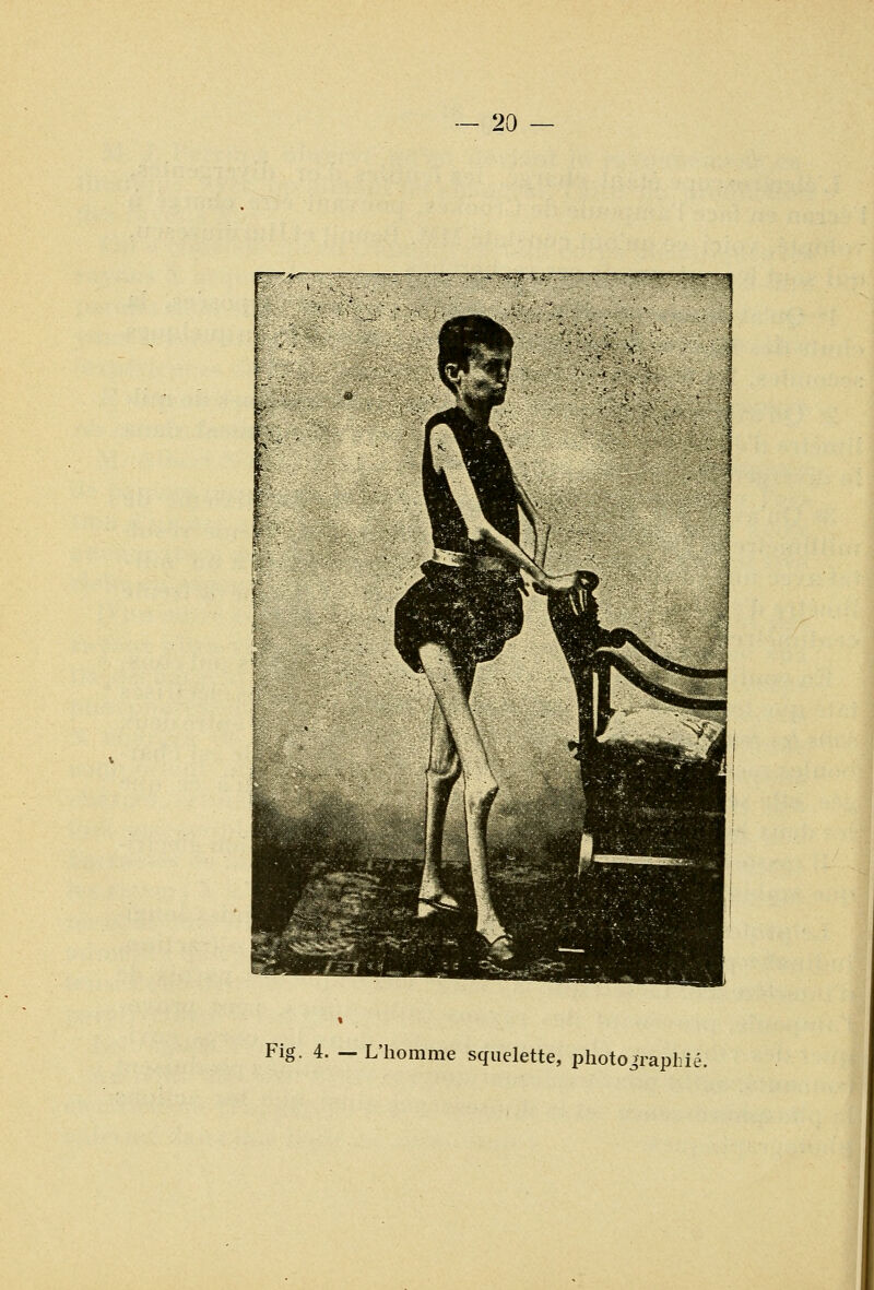 Fig. 4. — L'homme squelette, photographié.