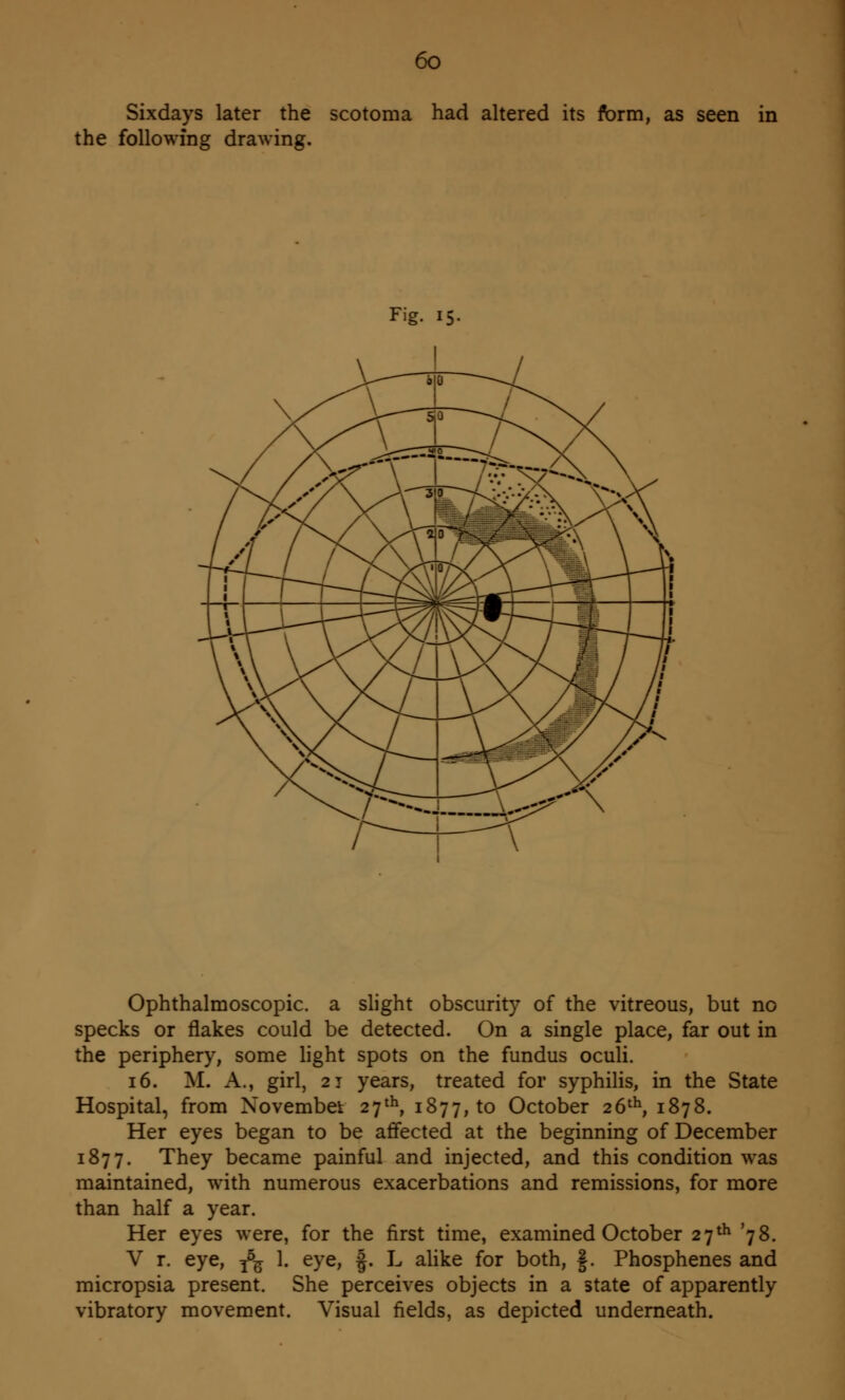 Sixdays later the scotoma had altered its form, as seen in the following drawing. Fig. 15. Ophthalmoscopic, a slight obscurity of the vitreous, but no specks or flakes could be detected. On a single place, far out in the periphery, some light spots on the fundus oculi. 16. M. A., girl, 21 years, treated for syphilis, in the State Hospital, from November 27th, 1877, to October 26th, 1878. Her eyes began to be affected at the beginning of December 1877. They became painful and injected, and this condition was maintained, with numerous exacerbations and remissions, for more than half a year. Her eyes were, for the first time, examined October 27th '78. V r. eye, ^ 1. eye, f. L alike for both, §. Phosphenes and micropsia present. She perceives objects in a state of apparently vibratory movement. Visual fields, as depicted underneath.