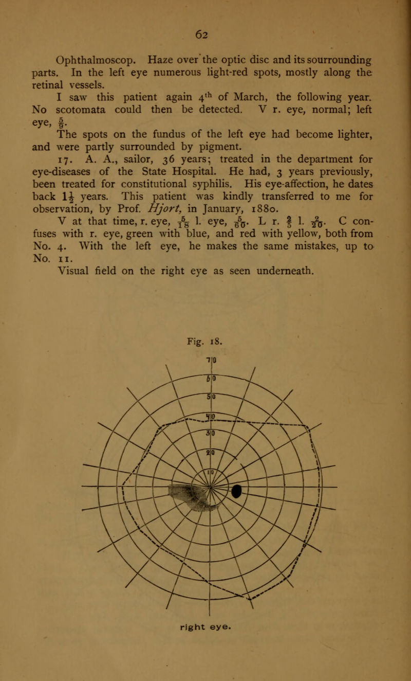 Ophthalmoscop. Haze over the optic disc and its sourroimding parts. In the left eye numerous light-red spots, mostly along the retinal vessels. I saw this patient again 4th of March, the following year. No scotomata could then be detected. V r. eye, normal; left eye, f. The spots on the fundus of the left eye had become lighter, and were partly surrounded by pigment. 17. A. A., sailor, 36 years; treated in the department for eye-diseases of the State Hospital. He had, 3 years previously, been treated for constitutional syphilis. His eye-affection, he dates back 1J years. This patient was kindly transferred to me for observation, by Prof. Hjort, in January, 1880. V at that time, r. eye, T5g 1. eye, B%. L r. | 1. fa. C con- fuses with r. eye, green with blue, and red with yellow, both from No. 4. With the left eye, he makes the same mistakes, up to No. 11. Visual field on the right eye as seen underneath. right eye.