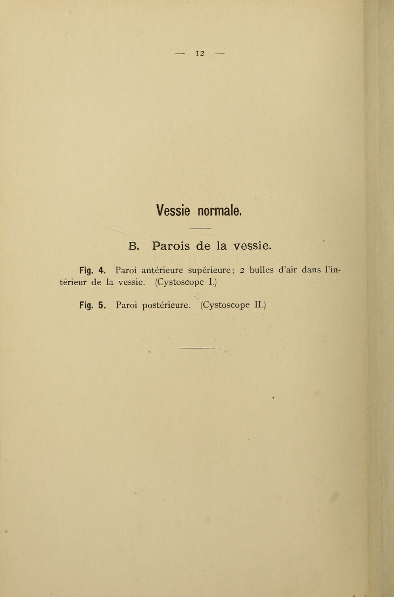 Vessie normale. B. Parois de la vessie. Fig. 4. Paroi antérieure supérieure ; 2 bulles d'air dans l'in- térieur de la vessie. (Cystoscope I.) Fig. 5. Paroi postérieure. (Cystoscope II.)