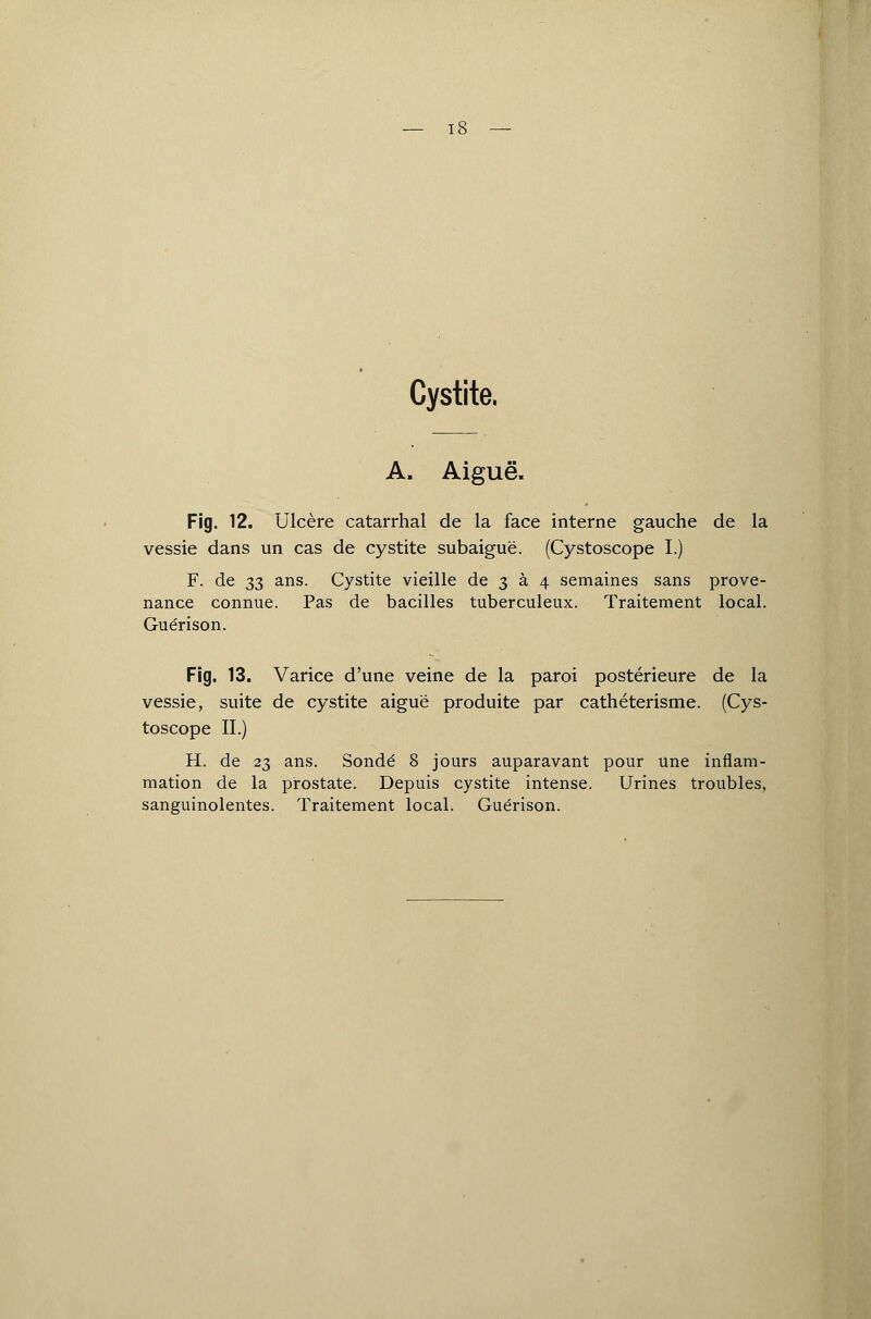 Cystite. A. Aiguë. Fïg. 12. Ulcère catarrhal de la face interne gauche de la vessie dans un cas de cystite subaiguë. (Cystoscope I.) F. de 33 ans. Cystite vieille de 3 à 4 semaines sans prove- nance connue. Pas de bacilles tuberculeux. Traitement local. Guérison. Fig. 13. Varice d'une veine de la paroi postérieure de la vessie, suite de cystite aiguë produite par cathéterisme. (Cys- toscope II.) H. de 23 ans. Sondé 8 jours auparavant pour Une inflam- mation de la prostate. Depuis cystite intense. Urines troubles, sanguinolentes. Traitement local. Guérison.