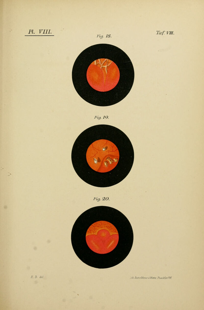 Fie;. 18. Taf. VM. Fig. 19. Fig. 20. lith.Aist.v.WmutâWirrUr, Fr*nkfiirî?M-