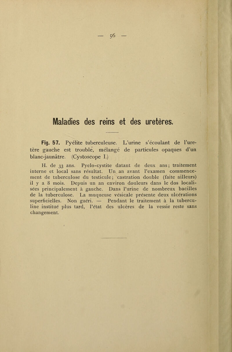 - 56 - Maladies des reins et des uretères. Fig. 57. Pyélite tuberculeuse. L'urine s'écoulant de l'ure- tère gauche est trouble, mélangé de particules opaques d'un blanc-jaunâtre. (Cystoscope I.) H. de 33 ans. Pyelo-cystite datant de deux ans ; traitement interne et local sans résultat. Un an avant l'examen commence- ment de tuberculose du testicule ; castration double (faite ailleurs) il y a 8 mois. Depuis un an environ douleurs dans le dos locali- sées principalement à gauche. Dans l'urine de nombreux bacilles de la tuberculose. La muqueuse vésicale présente deux ulcérations superficielles. Non guéri. — Pendant le traitement à la tubercu- line institué plus tard, l'état des ulcères de la vessie reste sans changement.