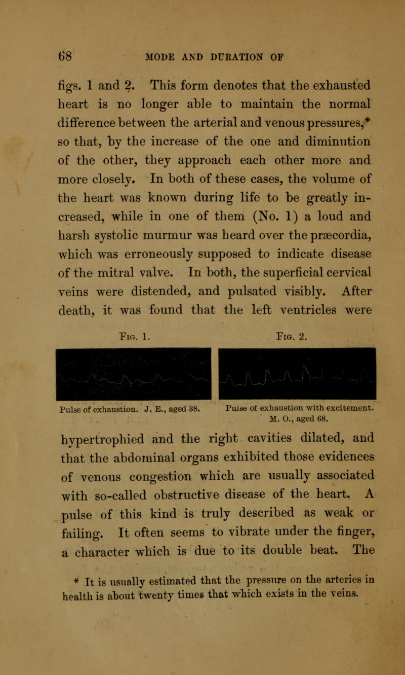 figs. 1 and 2. This form denotes that the exhausted heart is no longer able to maintain the normal difference between the arterial and venous pressures,* so that, by the increase of the one and diminution of the other, they approach each other more and more closely. In both of these cases, the volume of the heart was known during life to be greatly in- creased, while in one of them (No. 1) a loud and harsh systolic murmur was heard over the praecordia, which was erroneously supposed to indicate disease of the mitral valve. In both, the superficial cervical veins were distended, and pulsated visibly. After death, it was found that the left ventricles were Ficr. 1. Fig. 2. Pulse of exhaustion. J. E., aged 38. Pulse of exhaustion with excitement. M. 0., aged 68. hypertrophied and the right cavities dilated, and that the abdominal organs exhibited those evidences of venous congestion which are usually associated with so-called obstructive disease of the heart. A pulse of this kind is truly described as weak or failing. It often seems to vibrate under the finger, a character which is due to its double beat. The * It is usually estimated that the pressure on the arteries in health is about twenty times that which exists in the veins.