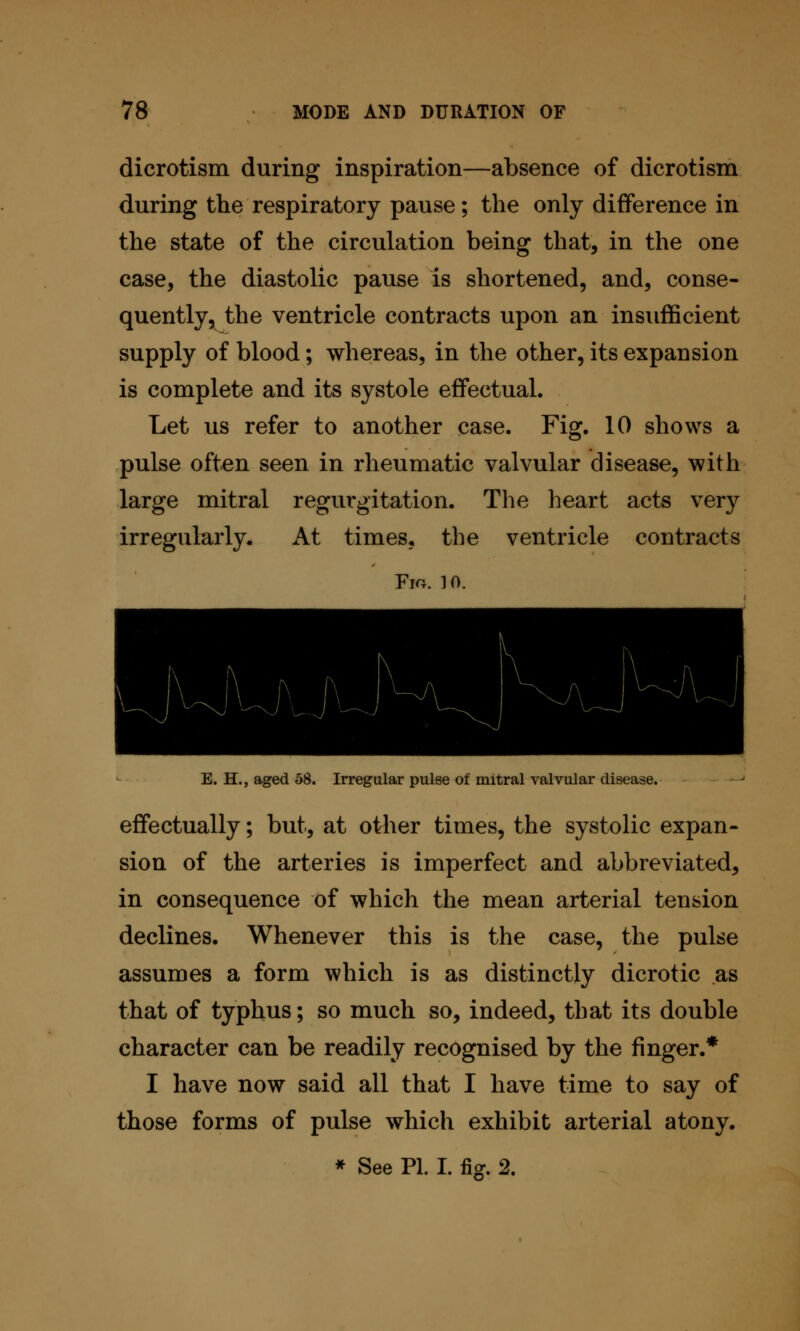 dicrotism during inspiration—absence of dicrotism during the respiratory pause; the only difference in the state of the circulation being that, in the one case, the diastolic pause is shortened, and, conse- quently, the ventricle contracts upon an insufficient supply of blood; whereas, in the other, its expansion is complete and its systole effectual. Let us refer to another case. Fig. 10 shows a pulse often seen in rheumatic valvular disease, with large mitral regurgitation. The heart acts very irregularly. At times, the ventricle contracts Fm. 10. E. H., aged 58. Irregular pulse of mitral valvular disease. effectually; but, at other times, the systolic expan- sion of the arteries is imperfect and abbreviated, in consequence of which the mean arterial tension declines. Whenever this is the case, the pulse assumes a form which is as distinctly dicrotic as that of typhus; so much so, indeed, that its double character can be readily recognised by the finger.* I have now said all that I have time to say of those forms of pulse which exhibit arterial atony. * See PL I. fig. 2.