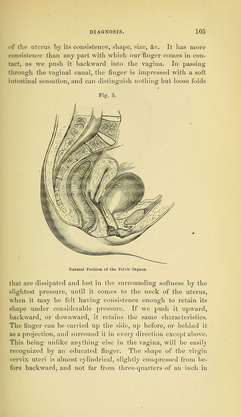 of the utGrus by its consistence, shape, size, &c. It lias more consistence than any part with which our finger comes in con- tact, as we push it backward into the vagina. In passing through the vaginal canal, the finger is impressed with a soft intestinal sensation, and can distinirnish notliiiiii: but loose folds Piff. 5. Natural Position of the Pelvic Organs. that are dissipated and lost in the surrounding softness by the slightest pressure, until it comes to the neck of the uterus, when it may be felt having consistence enough to retain its shape under considerable pressure. If we push it upward, backward, or downward, it retains the same characteristics. The finger can be carried up the side, up before, or behind it as a projection, and surround it in every direction except above. This being unlike anything else iu the vagina, will be easily recognized by an educated finger. Tlie shape of the virgin cervix uteri is almost cylindrical, slightly compressed from be- fore backward, and not far from three-quarters of an inch in