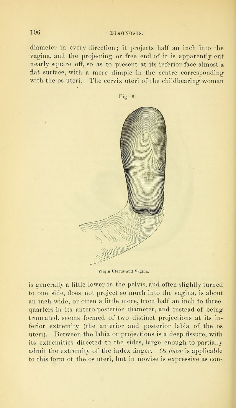 diameter in every direction; it projects half an inch into the vagina, and the projecting or free end of it is apparently cut nearly square off, so as to present at its inferior face almost a flat surface, with a mere dimple in the centre corresponding with the OS uteri. The cervix uteri of the childbearing woman Fiff. 6. Virgin Uterus and Vagina. is generally a little lower in the pelvis, and often slightly turned to one side, does not project so much into the vagina, is about an inch wide, or often a little more, from half an inch to three- quarters in its antero-posterior diameter, and instead of being truncated, seems formed of two distinct projections at its in- ferior extremity (the anterior and posterior labia of the os uteri). Between the labia or projections is a deep fissure, with its extremities directed to the sides, large enough to partially admit the extremity of the index finger. Os tincce is applicable to this form of the os uteri, but in nowise is expressive as con- i