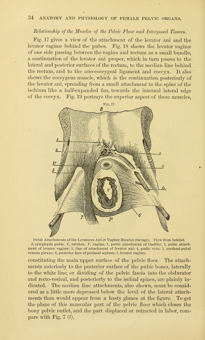 Relationship of the Muscles of the Pelvic Floor and Interposed Tissues. Fig. 17 gives a view of the attachment of the levator ani and the levator vagina3 behind the piibes. Fig. 18 shows the levator vaginae of one side passing between the vagina and rectum as a small bundle, a continuation of the levator ani proper, which in turn passes to the lateral and posterior surfaces of the rectum, to the median line behind the rectum, and to the ano-coccygeal ligament and coccyx. It also shows the coccygeus muscle, which is the continuation, posteriorly of the levator ani, spreading from a small attachment to the spine of the ischium like a half-expanded fan, towards the internal lateral edge of the coccyx. Fig. 19 portrays the superior aspect of these muscles, ri& 17 Pubic Attachments of the Levatores Ani et Vaginae Muscles (Savage). View from behind. S, symphysis pubis; V, urethra; V, vagina; 1, pubic attachment of bladder; 2, piibic attach- ment of levator vaginae; 3, line of attachment of levator ani; 4, pudic vein; 5, urethral-pubal venous plexus; 6, posterior face of perineal septum; 7, levator vaginae. constituting the main upper surface of the pelvic floor. The attach- ments anteriorly to the posterior surface of the pubic bones, laterally to the white line, or dividing of the pelvic fascia into the obdurator and recto-vesical, and posteriorly to the ischial spines, are plainly in- dicated. The median line attachments, also shown, must be consid- ered as a little more depressed below the level of the lateral attach- ments than would appear from a hasty glance at the figure. To get the plane of this muscular part of the pelvic floor which closes the bony pelvic outlet, and the part displaced or retracted in labor, com- pare with Fig. 7 (/).