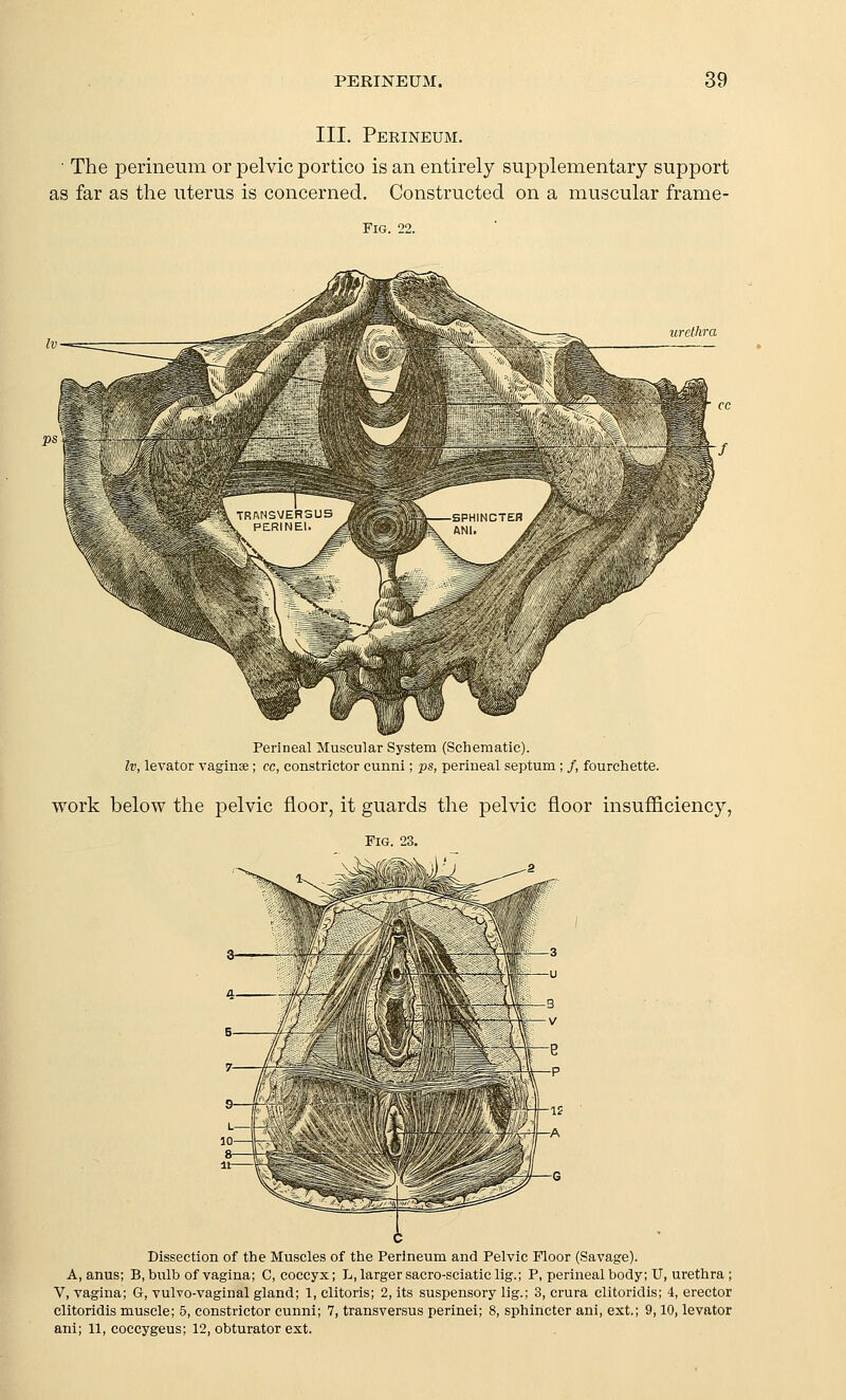 III. Perineum. ■ The perineum or pelvic portico is an entirely supplementary support as far as the uterus is concerned. Constructed on a muscular frame- FlG. 22. urethra Perineal Muscular System (Schematic). Iv, levator vaginae; cc, constrictor cunni; ps, perineal septum; /, fourchette. work below the pelvic floor, it guards the pelvic floor insufiiciency, Fig 23. Dissection of the Muscles of the Perineum and Pelvic Floor (Savage). A, anus; B, bulb of vagina; G, coccyx; L, larger sacro-sciaticlig.; P, perineal body; U, urethra ; V, vagina; G, vulvo-vaginal gland; 1, clitoris; 2, its suspensory lig.; 3, crura clitoridis; 4, erector clitoridis muscle; 5, constrictor cunni; 7, transversus perinei; 8, sphincter ani, ext.; 9,10, levator ani; n, coccygeus; 12, obturator ext.