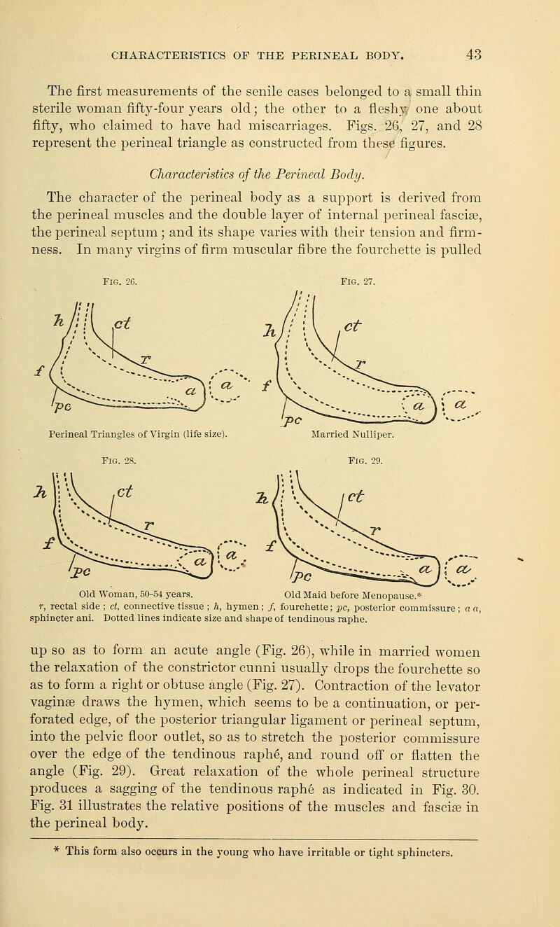 The first measurements of the senile cases belonged to a small thin sterile woman fifty-four years old; the other to a fleshy- one about fifty, who claimed to have had miscarriages. Figs. 26, 27, and 28 represent the perineal triangle as constructed from these figures. Characteristics of the Perineal Body. The character of the perineal body as a support is derived from the perineal muscles and the double layer of internal perineal fascise, the perineal septum ; and its shape varies with their tension and firm- ness. In many virgins of firm muscular fibre the fourchette is pulled Fig. 26. Fig. 27. ; a. Perineal Triangles of Virgin (life size). Fig. 28. a. 'j>c Married Nulliper. Fig. 29. ; a Old Woman, 50-54 years. <Z^ Old Maid before Menopause.=! r, rectal side ; ct, connective tissue ; h, hymen ; /, fourchette; pc, posterior commissure; a a, sphincter ani. Dotted lines indicate size and shape of tendinous raphe. up so as to form an acute angle (Fig. 26), while in married women the relaxation of the constrictor cunni usually drops the fourchette so as to form a right or obtuse angle (Fig. 27). Contraction of the levator vaginse draws the hymen, which seems to be a continuation, or per- forated edge, of the posterior triangular ligament or perineal septum, into the pelvic floor outlet, so as to stretch the posterior commissure over the edge of the tendinous raphe, and round off or flatten the angle (Fig. 29). Great relaxation of the whole perineal structure produces a sagging of the tendinous raphe as indicated in Fig. 30. Fig. 31 illustrates the relative positions of the muscles and fasciae in the perineal body. * This form also occurs in the young who have irritable or tight sphincters.