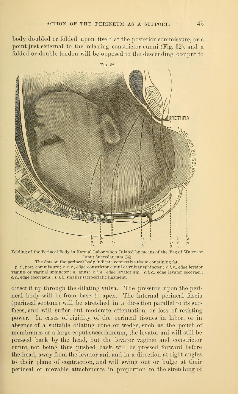 body doubled or folded upon itself at the posterior commissure, or a point just external to the relaxing constrictor cunni (Fig. 32), and a folded or double tendon will be opposed to the descending occiput to Fig. 32. Folding of the Perineal Body in Normal Labor when Dilated by means of the Bag of Waters or Caput Succedaneum {%). The dots on the perineal body indicate connective tissue containing fat. p. c, post, commissure ; e. c. c, edge constrictor cunni or vulvar sphincter ; e. I. v., edge levator yaginse or vaginal sphincter; a., anus; e.l.a., edge levator ani; e.l.c, edge levator coccygei; e. c, edge coccygeus ; s. s. L, smaller sacro-sciatic ligament. direct it up through the dilating vulva. The pressure upon the peri- neal body will be from base to apex. The internal perineal fascia (perineal septum) will be stretched in a direction parallel to its sur- faces, and will suffer but moderate attenuation, or loss of resisting power. In cases of rigidity of the perineal tissues in labor, or in absence of a suitable dilating cone or wedge, such as the pouch of membranes or a large caput succedaneum, the levator ani will still be pressed back by the head, but the levator vaginse and constrictor cunni, not being thus pushed back, will be pressed forward before the head, away from the levator ani, and in a direction at right angles to their plane of contraction, and will swing out or bulge at their perineal or movable attachments in proportion to the stretching of