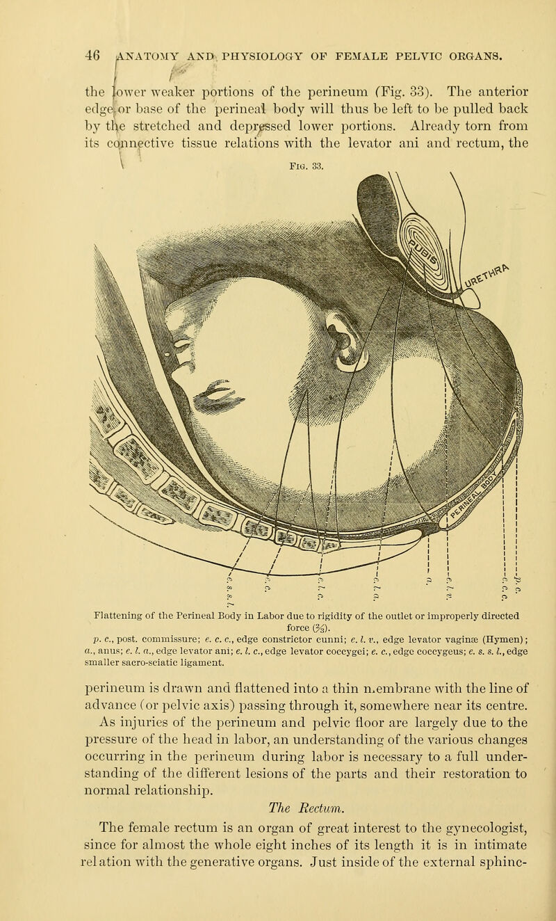 the lower weaker portions of the perineum (Fig. 33). The anterior edge^or base of the perineal body will thus be left to be pulled back by tl'ne stretched and depressed lower portions. Already torn from its cqnngctive tissue relations with the levator ani and rectum, the Flattening of the Perineal Body in Labor due to rigidity of the outlet or improperly directed force (%). p. c, post, commissure; e. c. c, edge constrictor cunni; e. I. v., edge levator vaginae (Hymen); a., anus; e. I. a., edge levator ani; e. I. c, edge levator coccygei; e. c, edge coccygeus; e. s. s. I., edge smaller sacro-sciatic ligament. perineum is drawn and flattened into a thin membrane with the line of advance (or pelvic axis) passing through it, somewhere near its centre. As injuries of the perineum and pelvic floor are largely due to the pressure of the head in labor, an understanding of the various changes occurring in the perineum during labor is necessary to a full under- standing of the different lesions of the parts and their restoration to normal relationship. The Rectum. The female rectum is an organ of great interest to the gynecologist, since for almost the whole eight inches of its length it is in intimate relation with the generative organs. Just inside of the external sphinc-