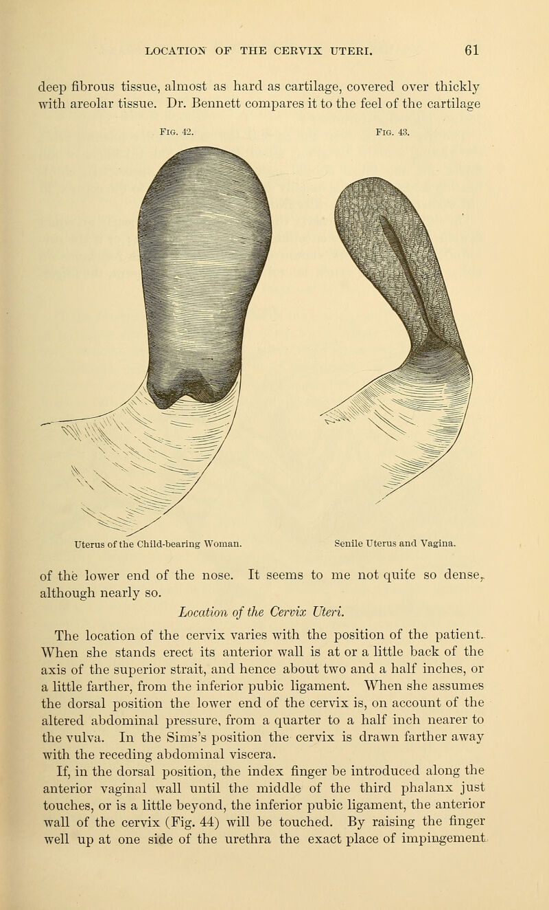 deep fibrous tissue, almost as hard as cartilage, covered over thickly with areolar tissue. Dr. Bennett compares it to the feel of the cartilage Fig. 42. Fig. 43. Uterus of the Child-bearing Woman. Senile Uterus and Vagina. of the lower end of the nose. It seems to me not quite so dense^ although nearly so. Location of the Cervix Uteri. The location of the cervix varies with the position of the patient.. When she stands erect its anterior wall is at or a little back of the axis of the superior strait, and hence about two and a half inches, or a little farther, from the inferior pubic ligament. When she assumes the dorsal position the lower end of the cervix is, on account of the altered abdominal pressure, from a quarter to a half inch nearer to the vulva. In the Sims's position the cervix is drawn farther away with the receding abdominal viscera. If, in the dorsal position, the index finger be introduced along the anterior vaginal wall until the middle of the third phalanx just touches, or is a little beyond, the inferior pubic ligament, the anterior wall of the cervix (Fig. 44) will be touched. By raising the finger well up at one side of the urethra the exact place of impingement.